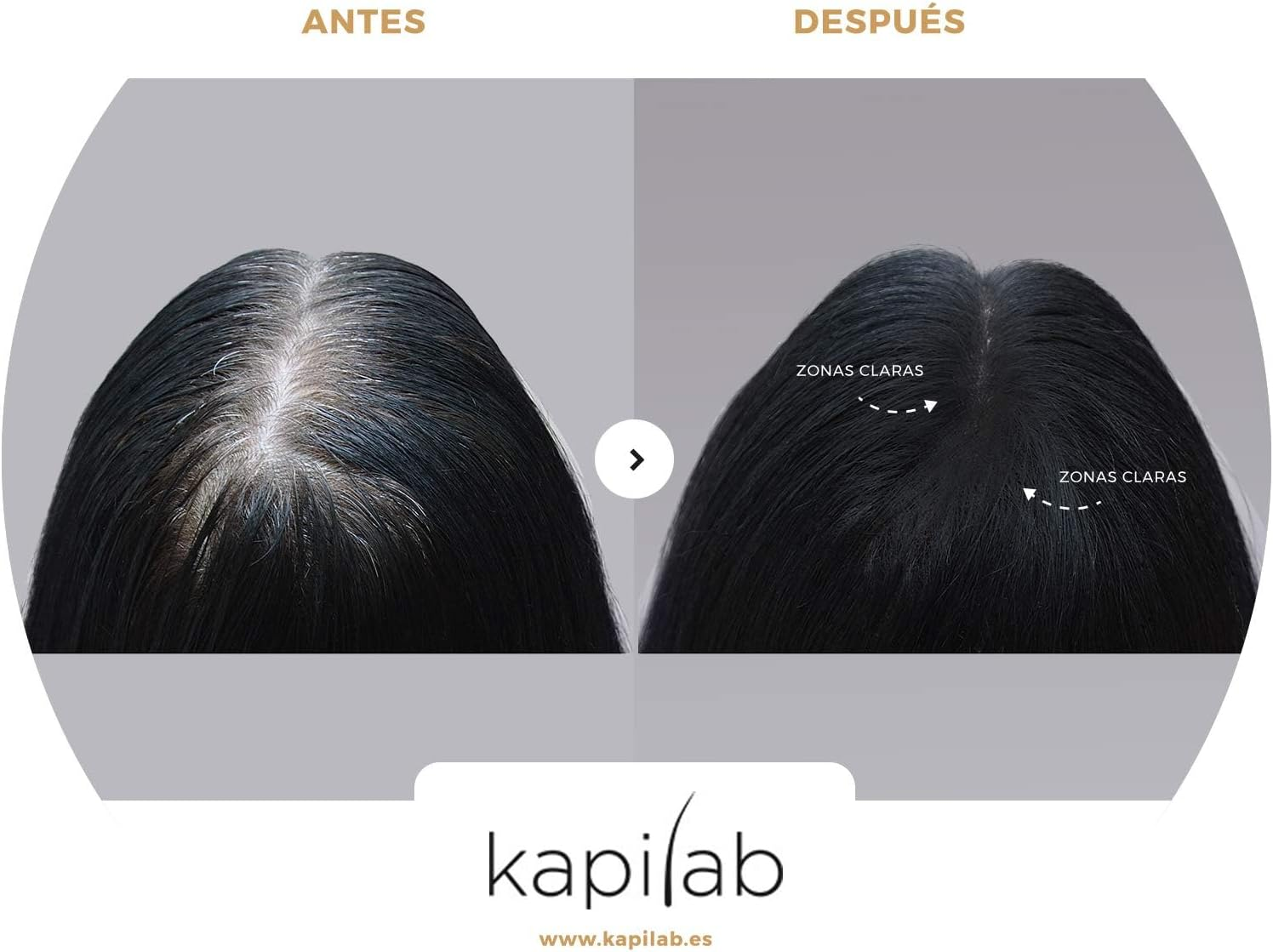 Kapilab Scalp Mask - 4G - Medium Brown image number 3