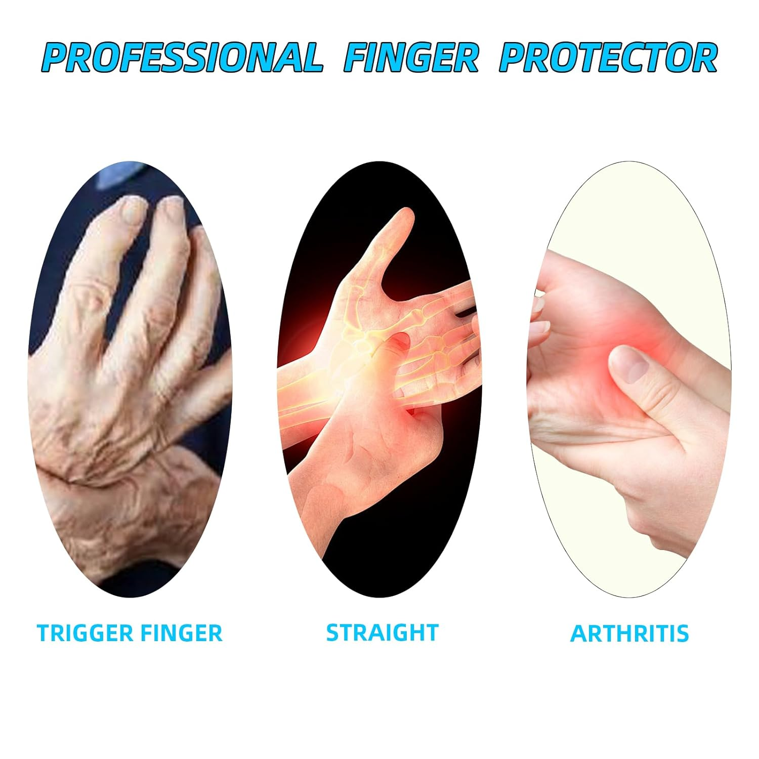 Luojinluoda 10 Pack Oval Finger Splints & Sleeves Kit, Waterproof Trigger Finger Splints, Adjustable Thumb Brace Support for Straightening, Thumb Splint & Finger Brace for Arthritis, Mallet Finger Splint image number 1