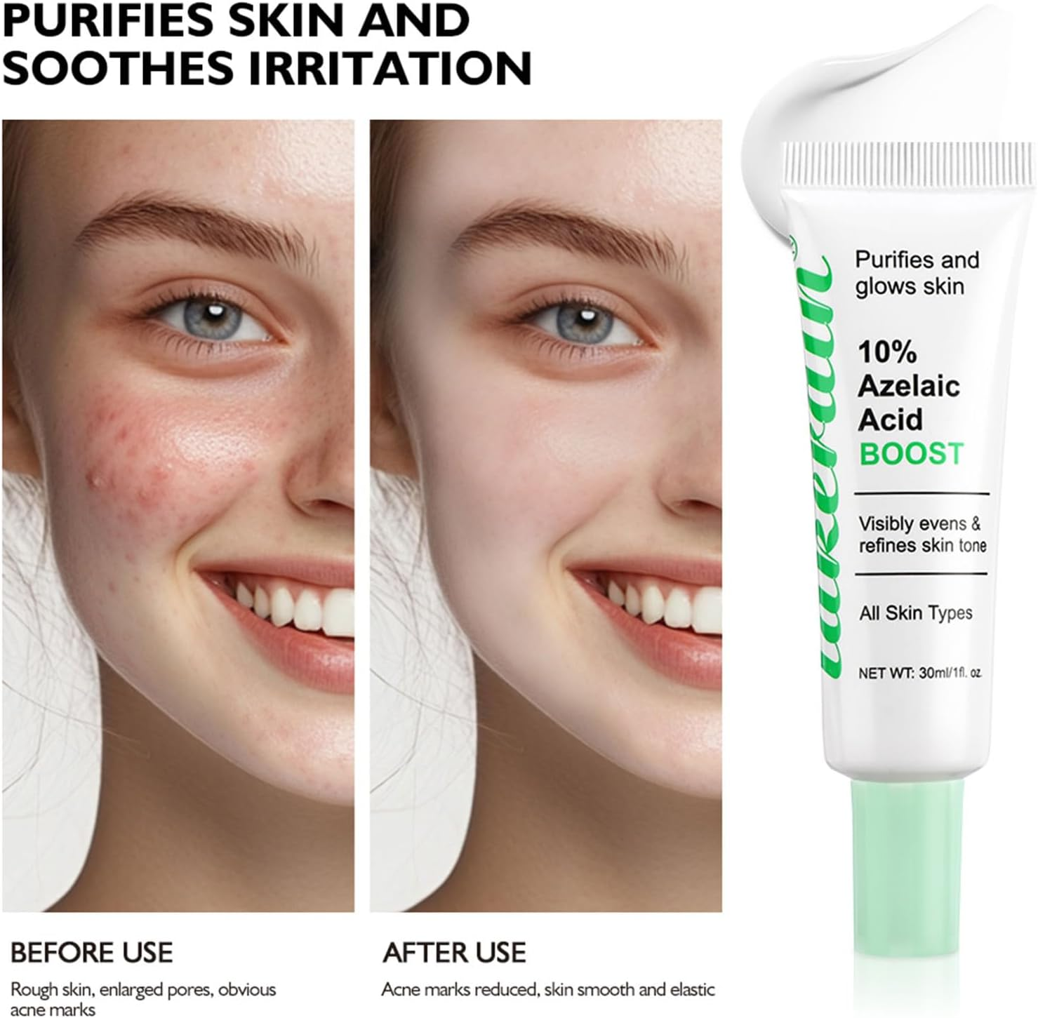 Azelaic Acid Booster Cream Gel for Face and Skin Balance Moisturizer and Nourishing Facial Skin Beauty Care for Sensitive Skin(Getaria, 10% Azelaic Acid)