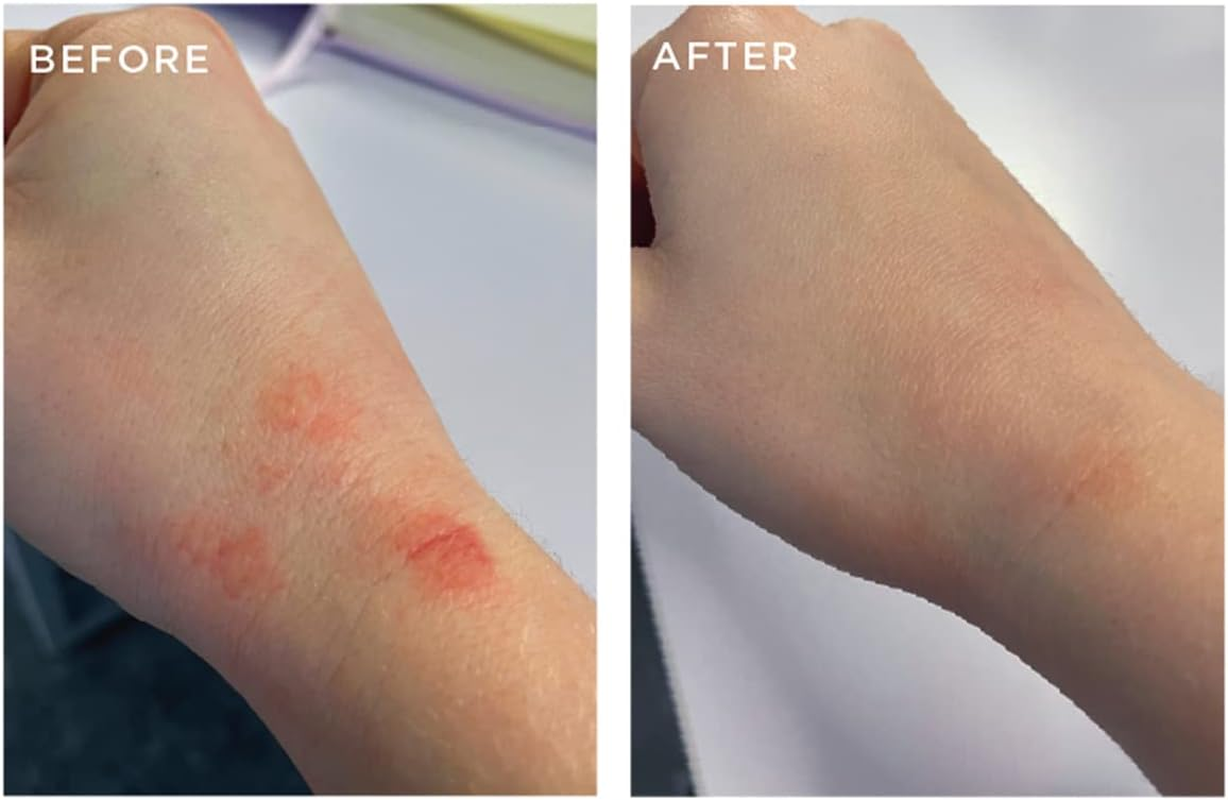 Pestle & Mortar Essentials the Hand Wash 300Ml, for Dry, Itchy, Sensitive and Eczema-Prone Skin, Cleans & Hydrates Hands, Paraben Free, SLS Free & Unscented image number 5