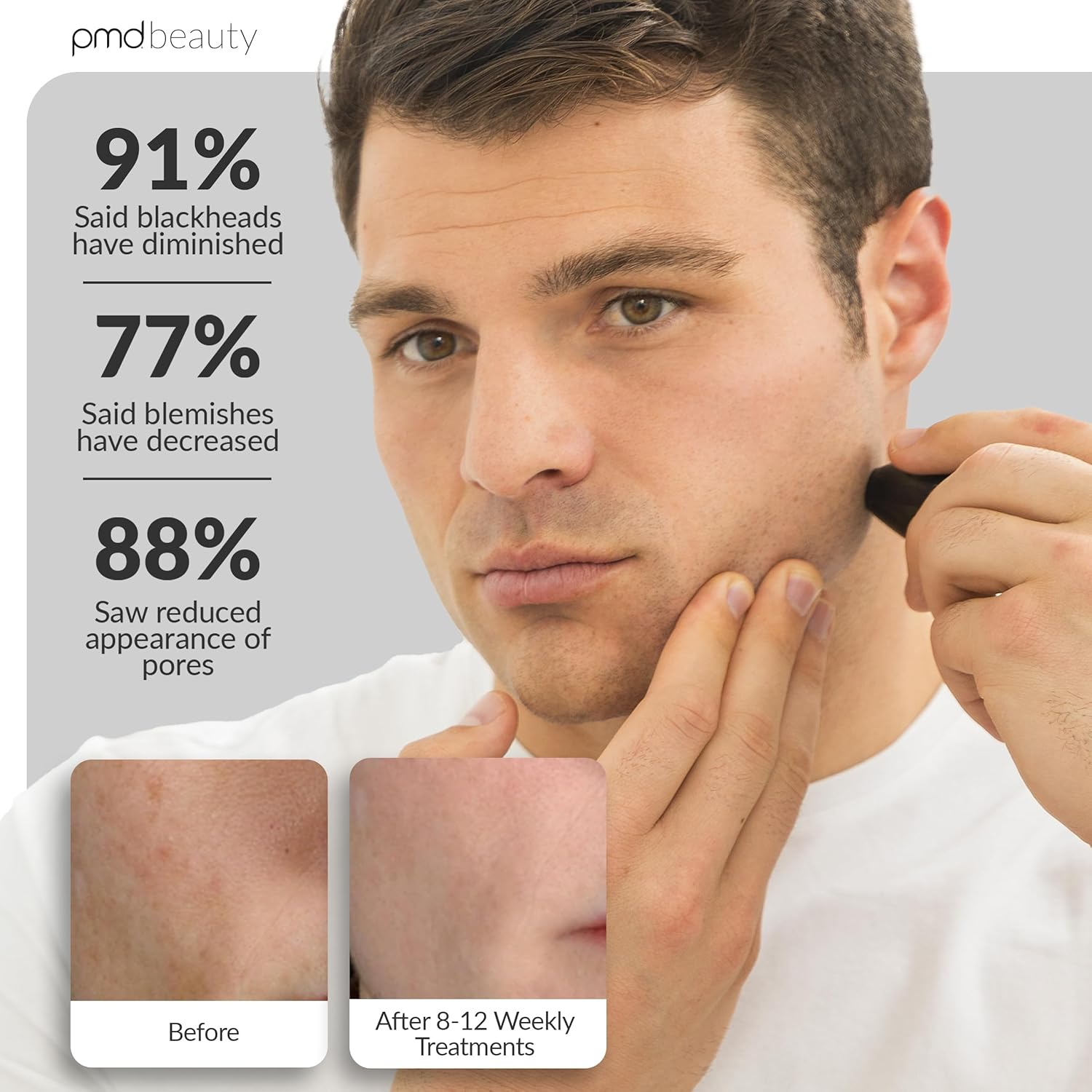 PMD Personal Microderm Man - At-Home Microdermabrasion Machine with Kit for Face & Body - Exfoliating Crystals and Vacuum Suction for Bold and Striking Skin image number 3