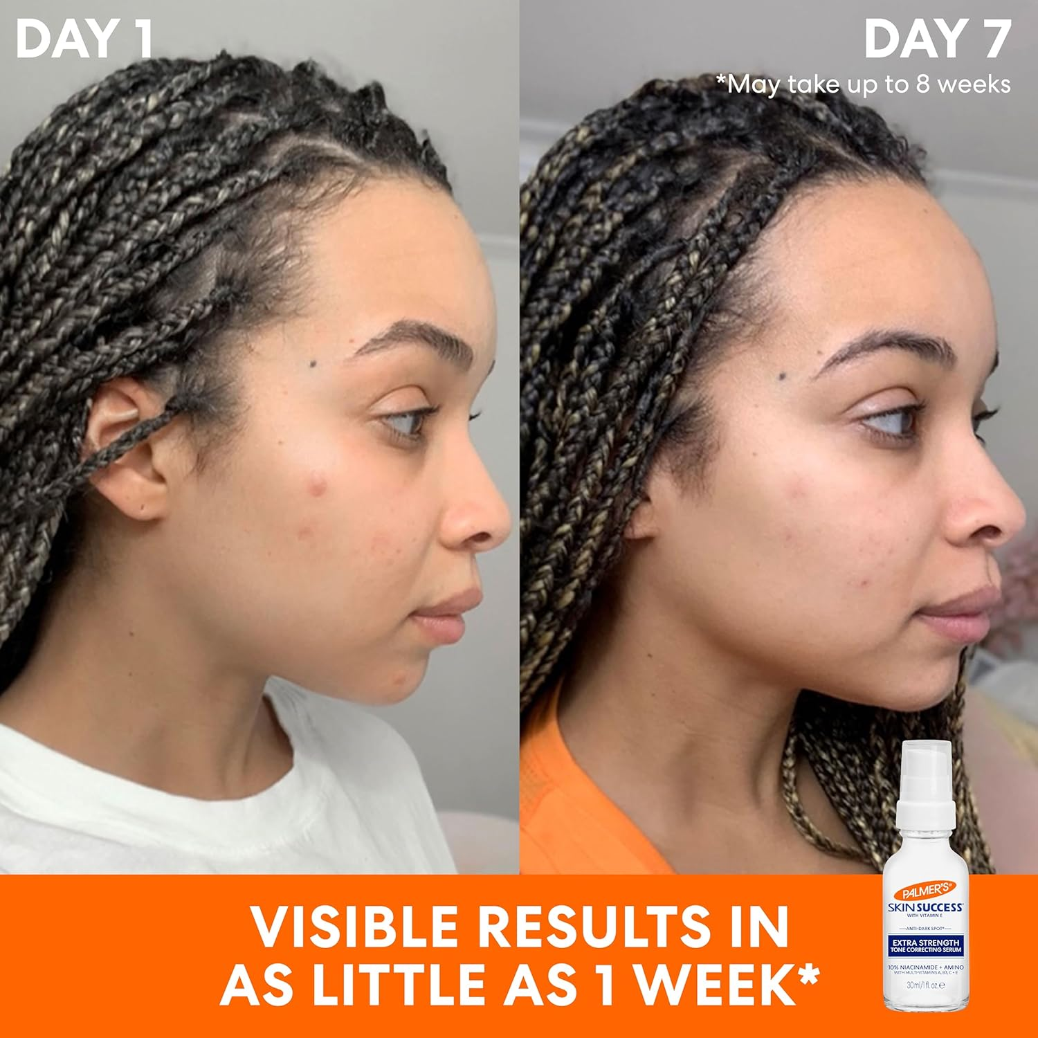 Palmer'S Skin Success Extra Strength Tone Correcting Serum 30Ml image number 4