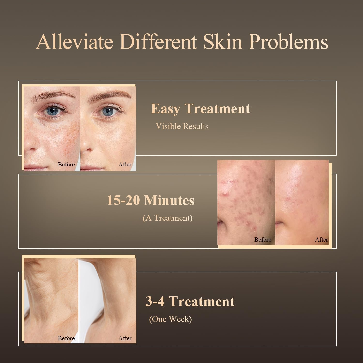 Red Light Therapy Face Mask for Face & Neck &ndash; 8 Light Modes with 850Nm NIR Infrared, 7-Color Beauty Light, Rechargeable Led Face Mask for Anti-Aging, Skin Firming & Radiant Glow at Home image number 1