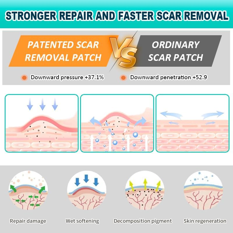 Medical-Grade Silicone Scar Tape &ndash; 4Cm X 2.1M Roll &ndash; Skin-Coloured, Breathable, Reusable Strip with Protective Backing &ndash; Soft, Skin-Like Texture