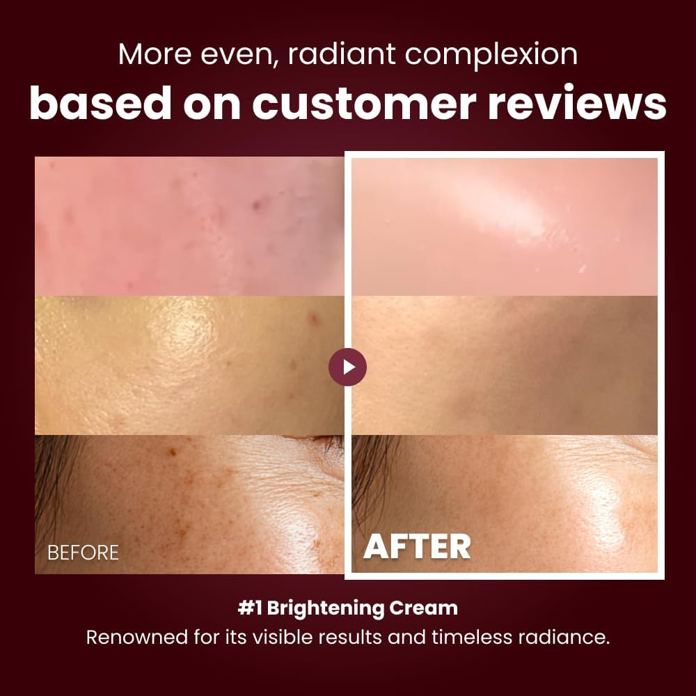 Kopher Curepair Mela Cream[4Ever Edition] with 10GF Soothing & Repairing Moisturizer for Sensitive Skin - Redness Relief, Barrier Strengthening Skin, Korean Skincare (1.18 Fl.Oz.) image number 1