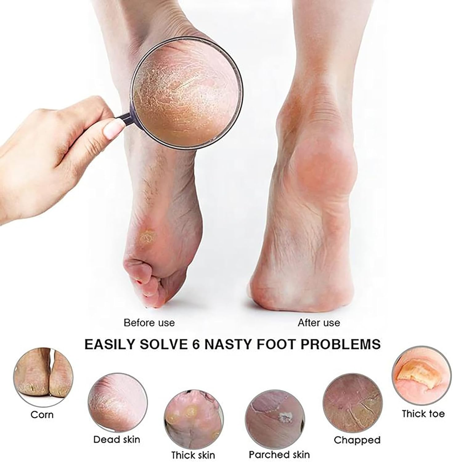 Pumice Stone for Feet, Black Foot Scrubber and Callus Remover, Beech Wood Handle with Black Silicon Carbide, Effective Heel Scraper and Foot Exfoliator for Pedicure