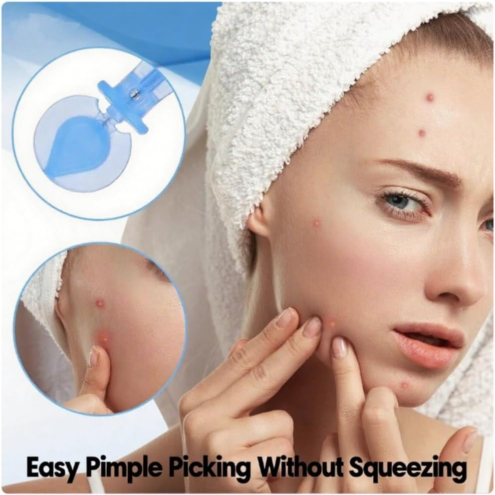 Blue Blackhead Remover Needles, 50Pcs Blackhead Acne Pimple Popper Needles, Acne Pimple Popper Needle Remover Tools for Women Home Use image number 3