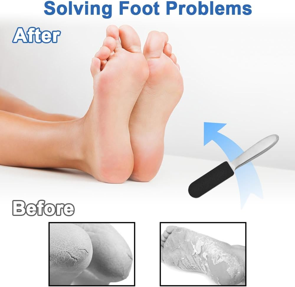 Foot File for Hardened or Dry Skin, Stainless Steel, Foot File with Replacement Sandpaper, Coarse and Fine, Stainless Steel Callus Rasp, Callus File, Foot Care, Professional Callus File for Callus image number 2
