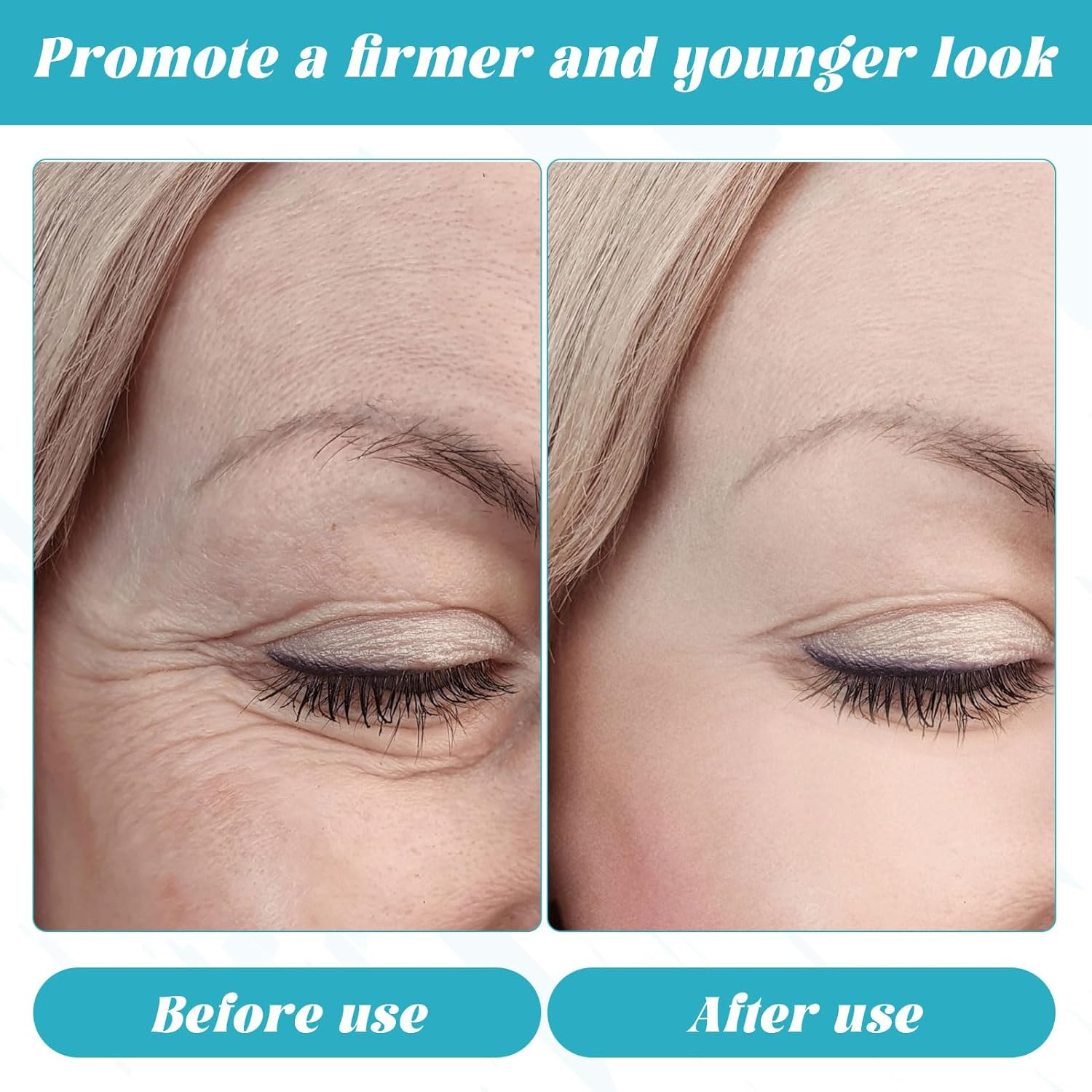 Face Tape for Wrinkles, Silicone Wrinkle Patches, Wrinkles Schminkles, Reusable Face Tape for Reducing Forehead Eye, Mouth or Forehead Wrinkles, anti Wrinkle Patches for Face Overnight Prevention image number 1