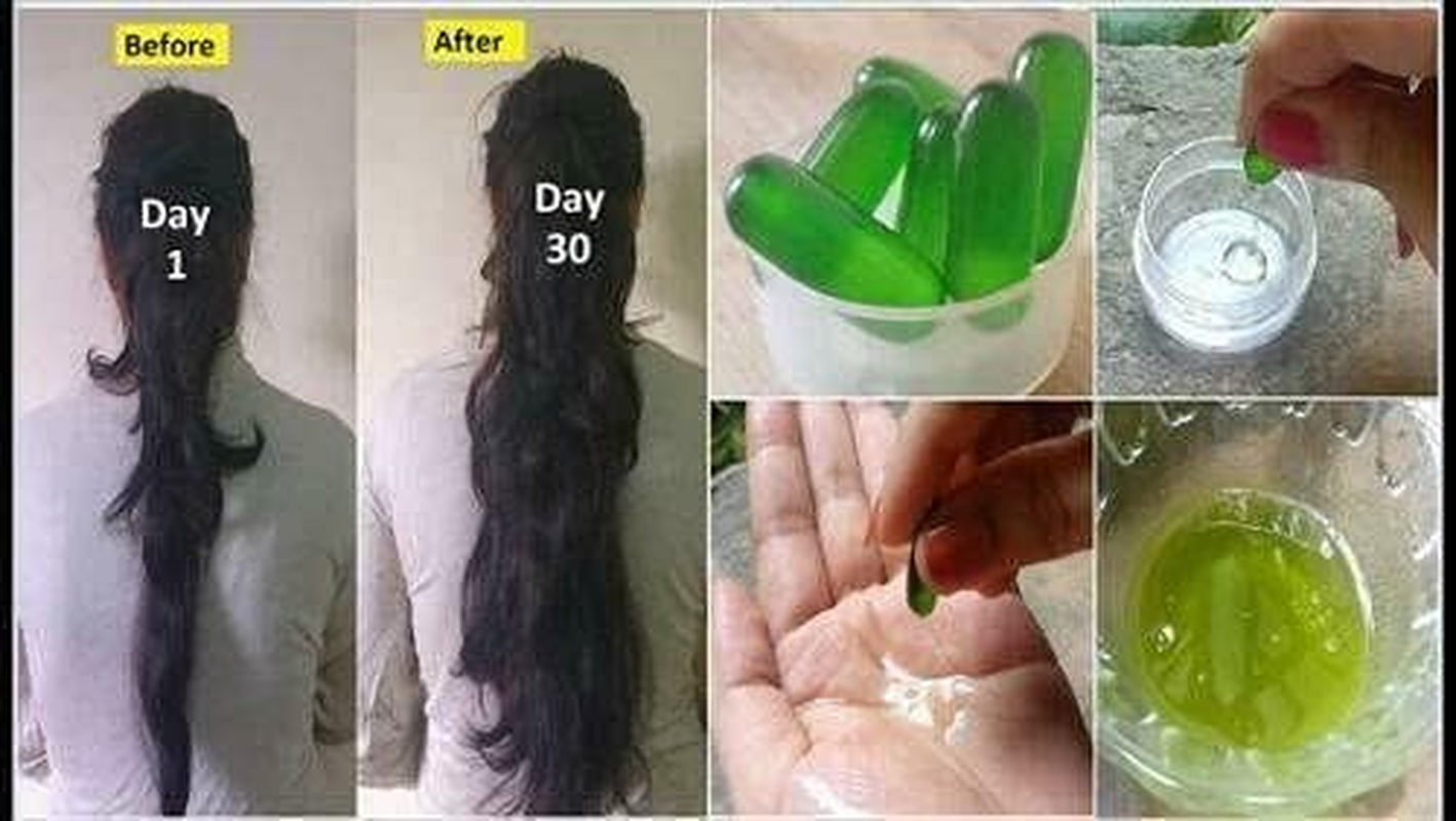 Evion 400 MG Vitamin E Capsule for Face, Hair, Pimple, Glowing Skin, Dark Circles, Skin Whitening & Control Hair Loss, 100 Capsules image number 1