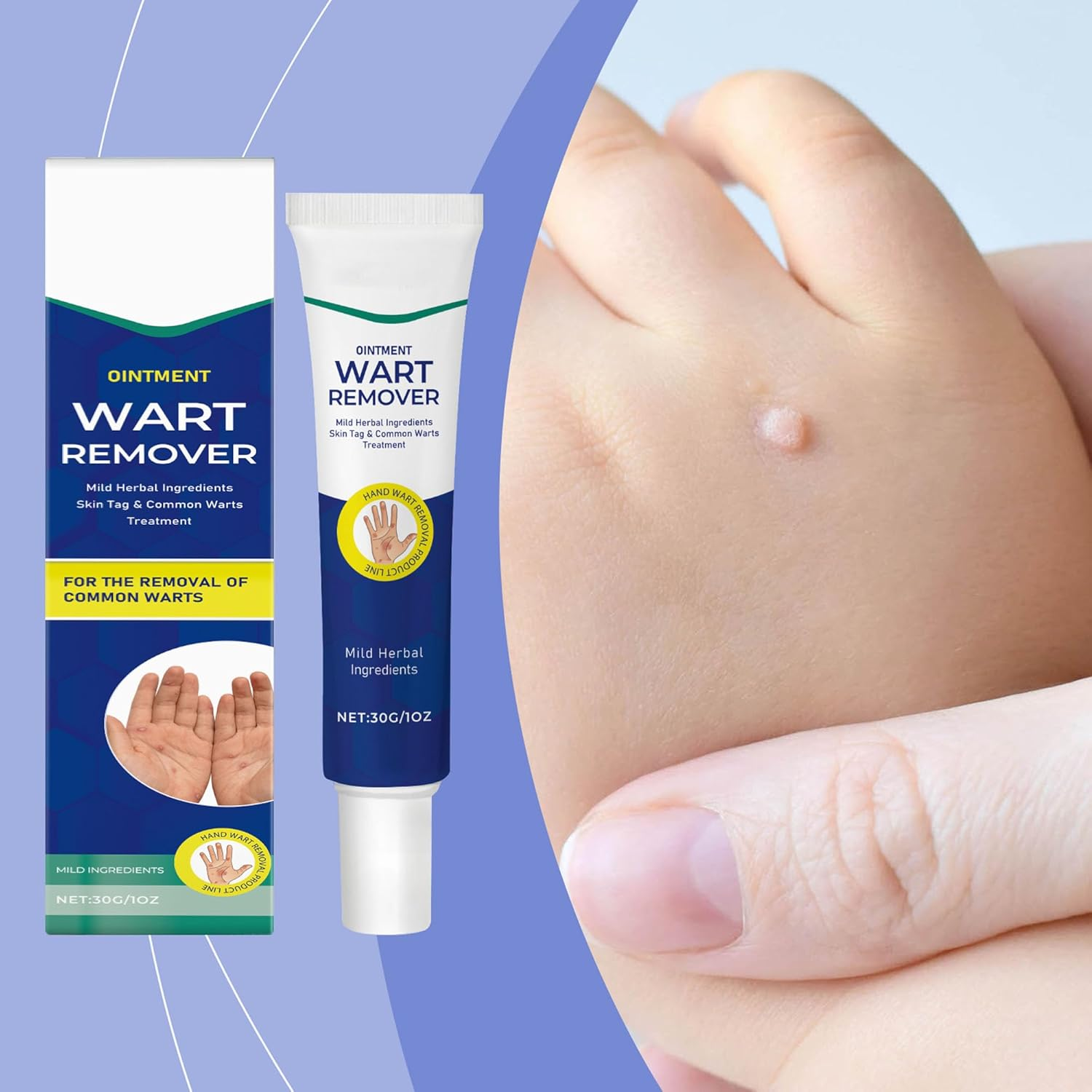 Wart Remover Cream 30G, Suitable for Common Warts, Plantar Warts, Corns, Moles, Calluses and Moles, Wart Remover for Hands and Body image number 2
