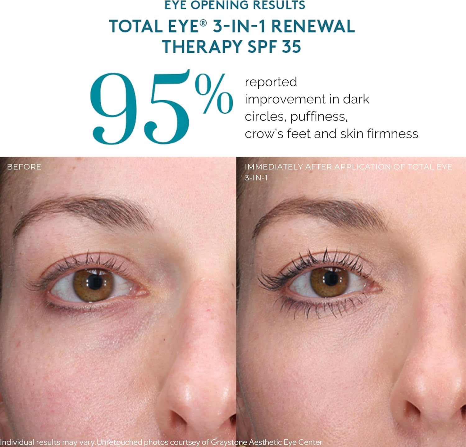 Colorescience Total Eye 3-In-1 Renewal Therapy, 0.23 Fl Oz, Medium image number 2