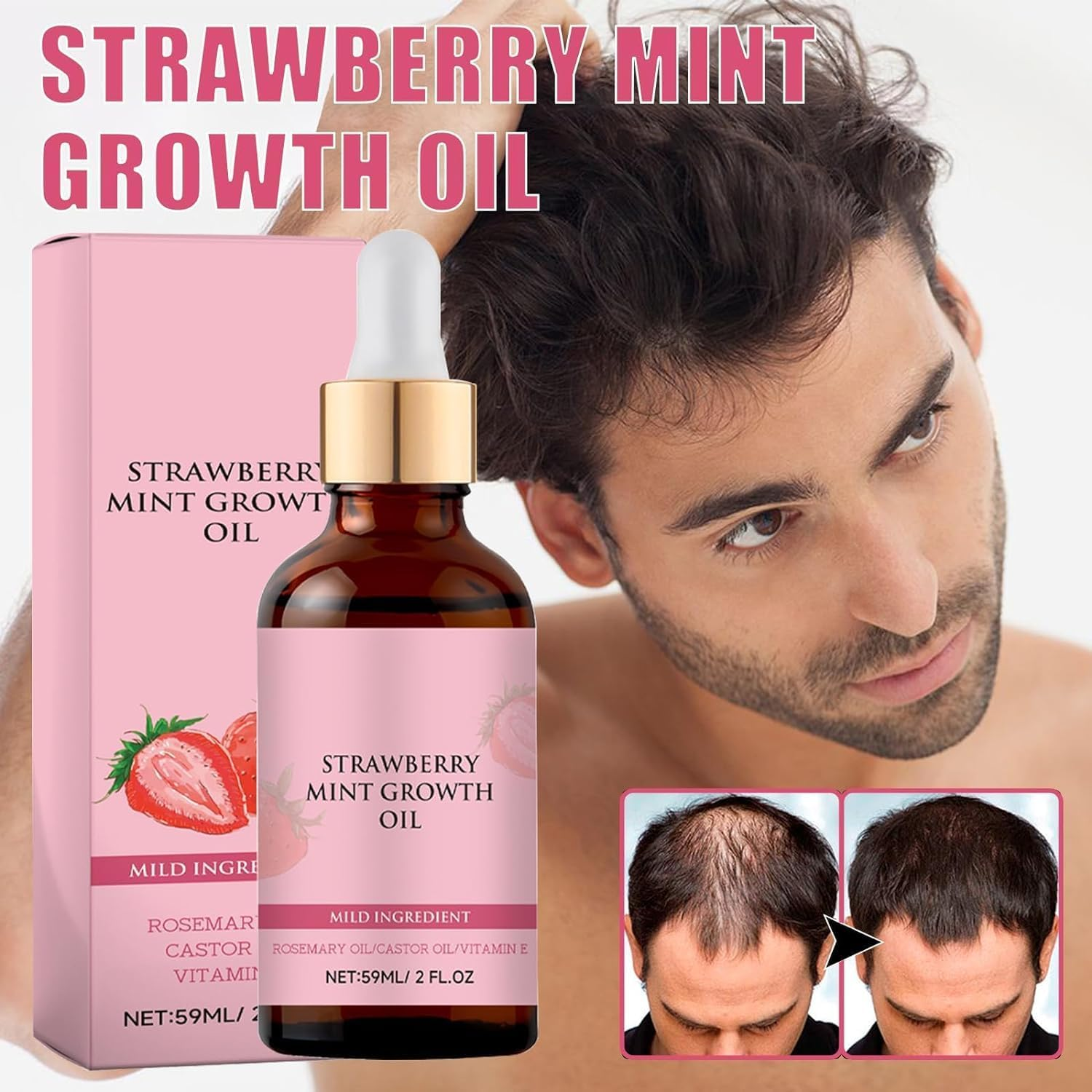 GTWEPZ 2Pcs Strawberry Mint Growth Oil,Strawberry Mint Hair Growth Oil,Organic Hair Growth Serum for Thin Hair Dry Damaged Hair, Beige image number 6