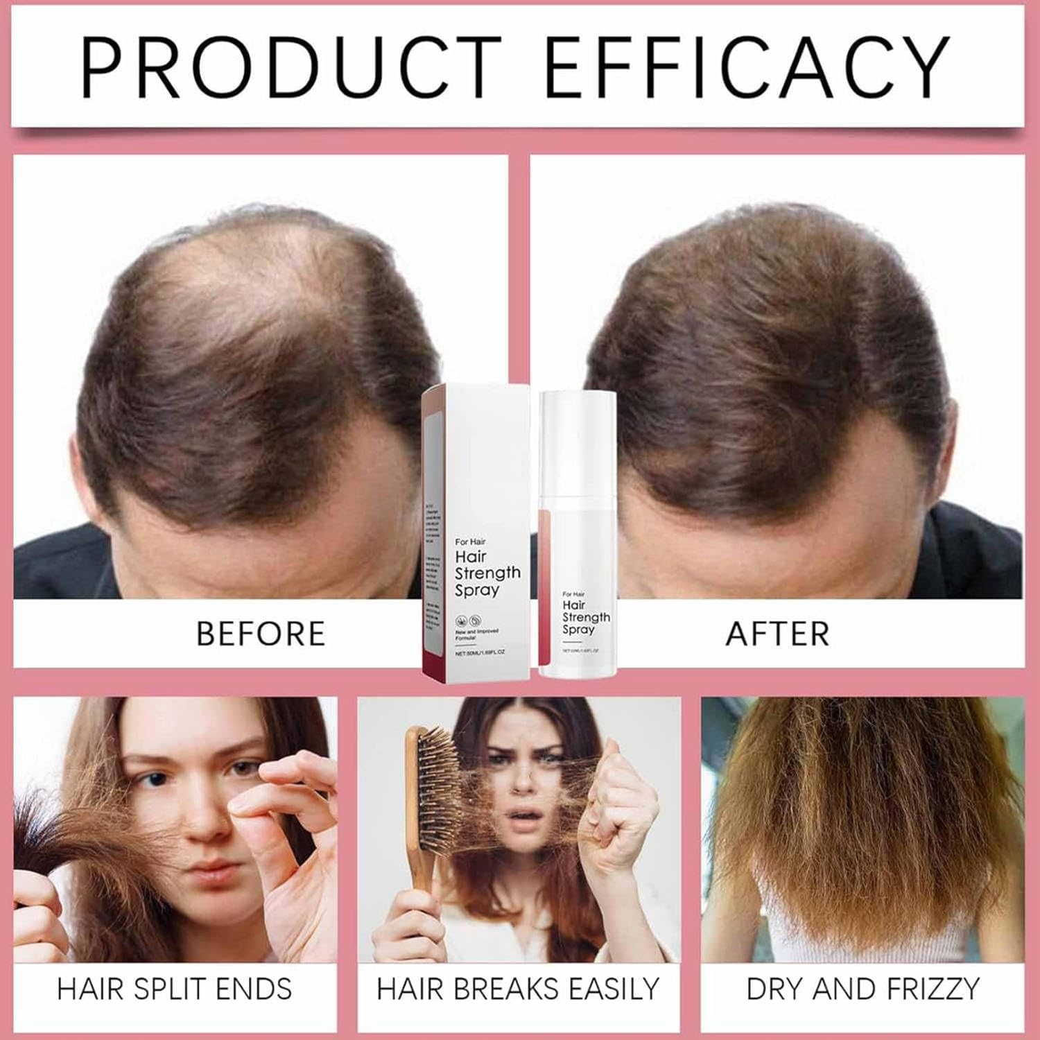 Hair Growth Oil Spray, Natural Hair Growth Oil, Non-Greasy, Damage Repair, Loss Prevention, Nourishes Hair & Scalp (2Pcs) image number 1