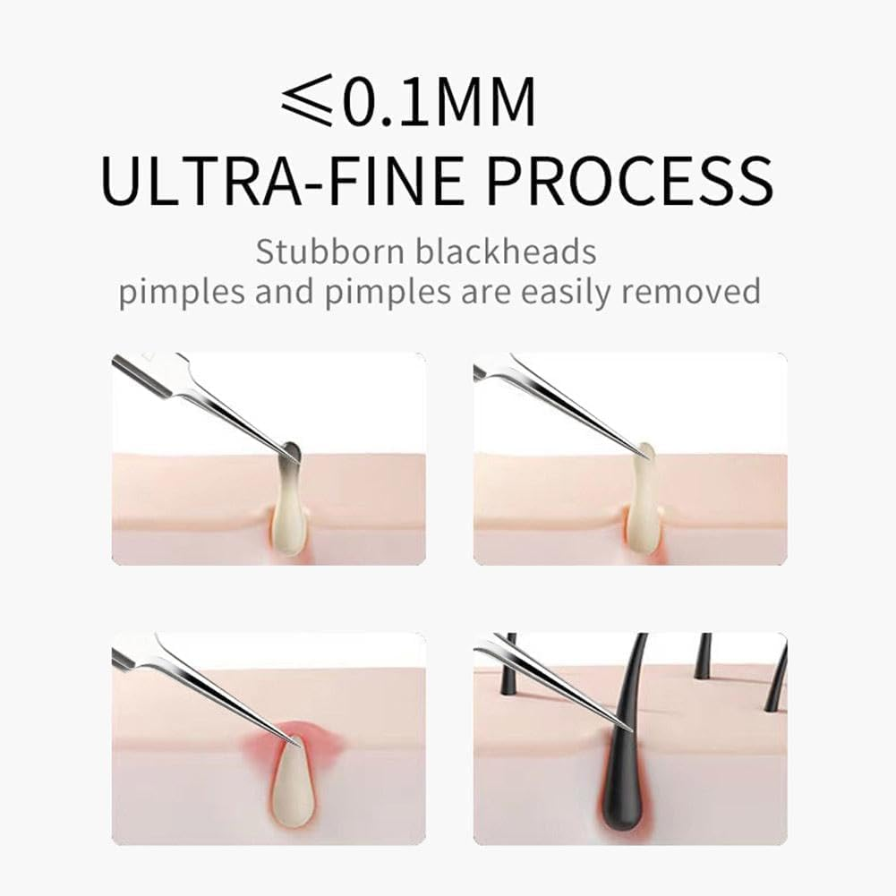 3Pcs Professional Blackhead Tweezer Professional Facial Blackhead Remover Tweezers Precision Extractor Acne Removal Kit Pimple Popper Tool with Storage Box image number 2