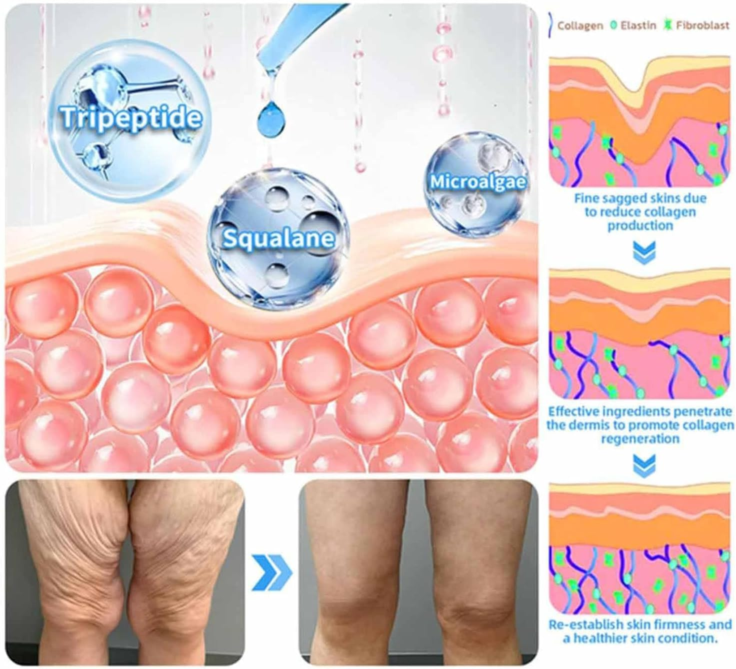 Aeehfengf Firm Tighten Skin Tighten Cream,Firm and Tighten Skin Cream,Aeehfengf Skin Firming Cream,Skin Tightening Cream,Anti-Aging Neck Cream,Skin Firming Protein Cream,Elastin Moisturizer (2Pcs) - 1Pc image number 6