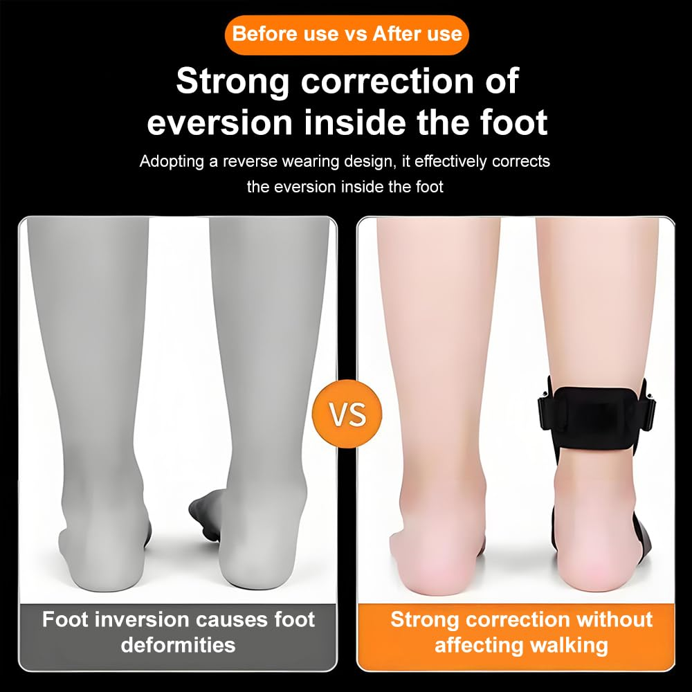 Plantar Fasciitis Night Splint Socks, Heel Pain Relief Plantar Fasciitis, Soft Stretching Boot Splint for Aching Feet & Heel Relief, Plantar Fasciitis Night Splint Sock, Right or Left Foot for Achilles Tendonitis Drop Foot (S) image number 6