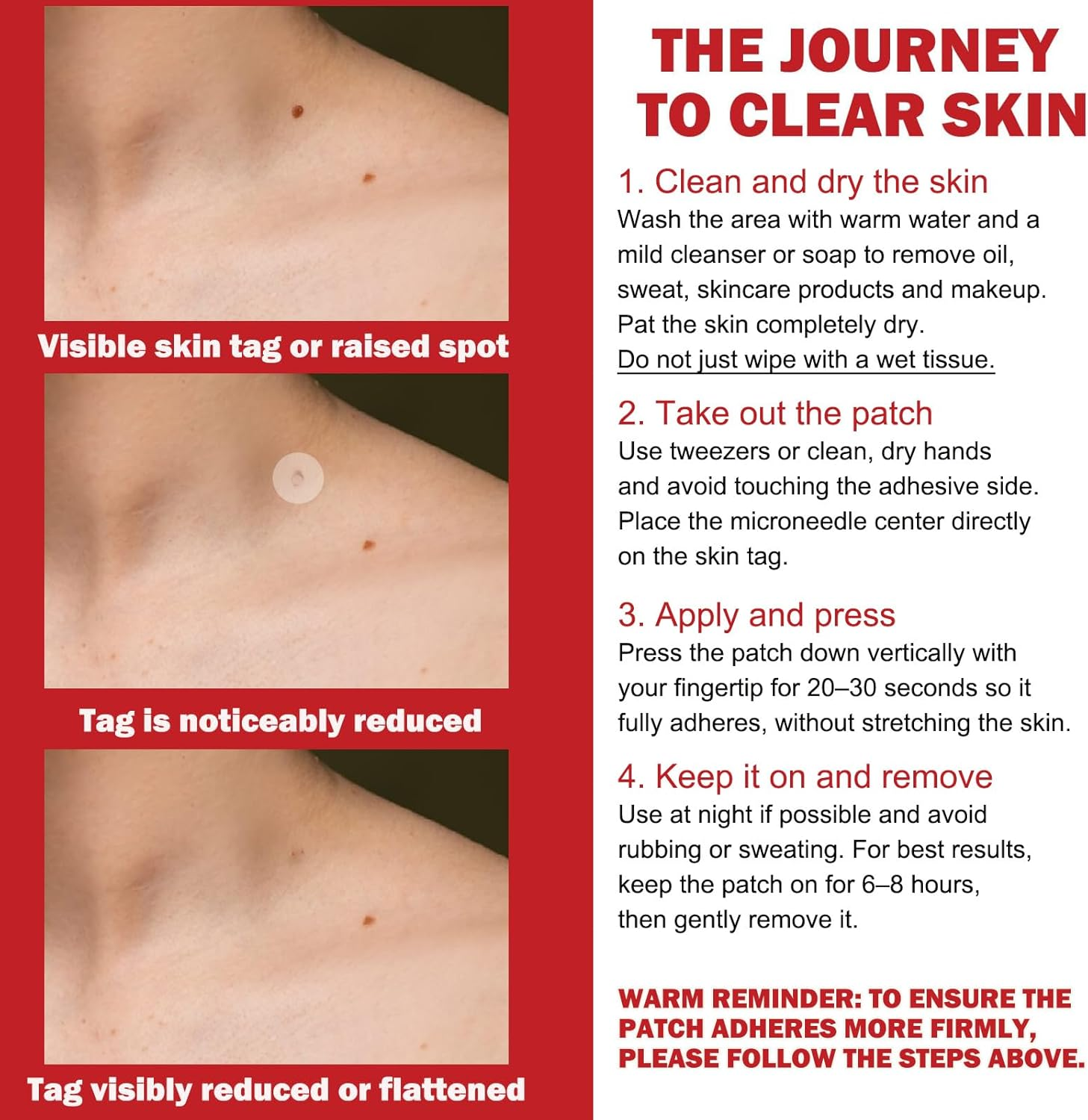 18Pcs Microneedle Skin Tag Patches &ndash; Gentle Microdarts with Plant-Based Formula, Sweatproof Daily Care Stickers for Face & Body, Comfort Fit for Sensitive Skin Designed for Daily Use（2 Pack）