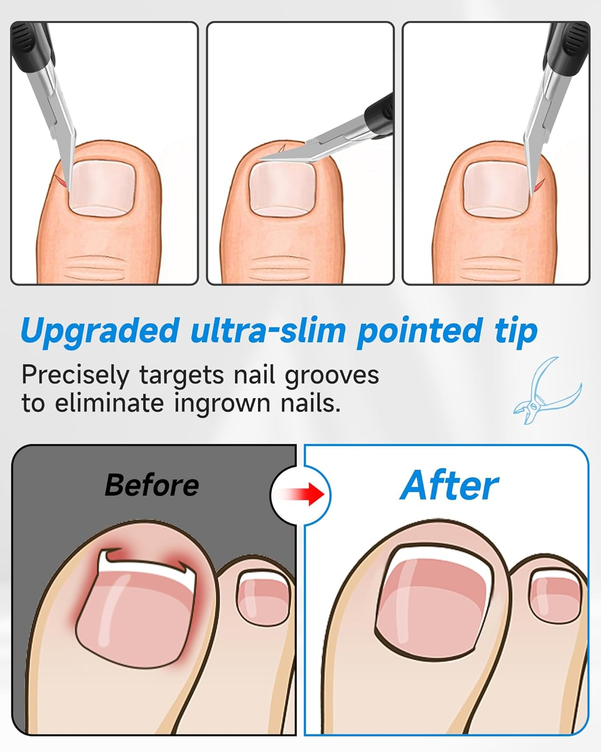 Tisojpod Nail Clippers,Toenail Clipper for Ingrown or Thick Toe Nails,Fingernail Clipper for Men Women Seniors with Stainless Steel Straight Blade Soft Handle Nail Cutter Black