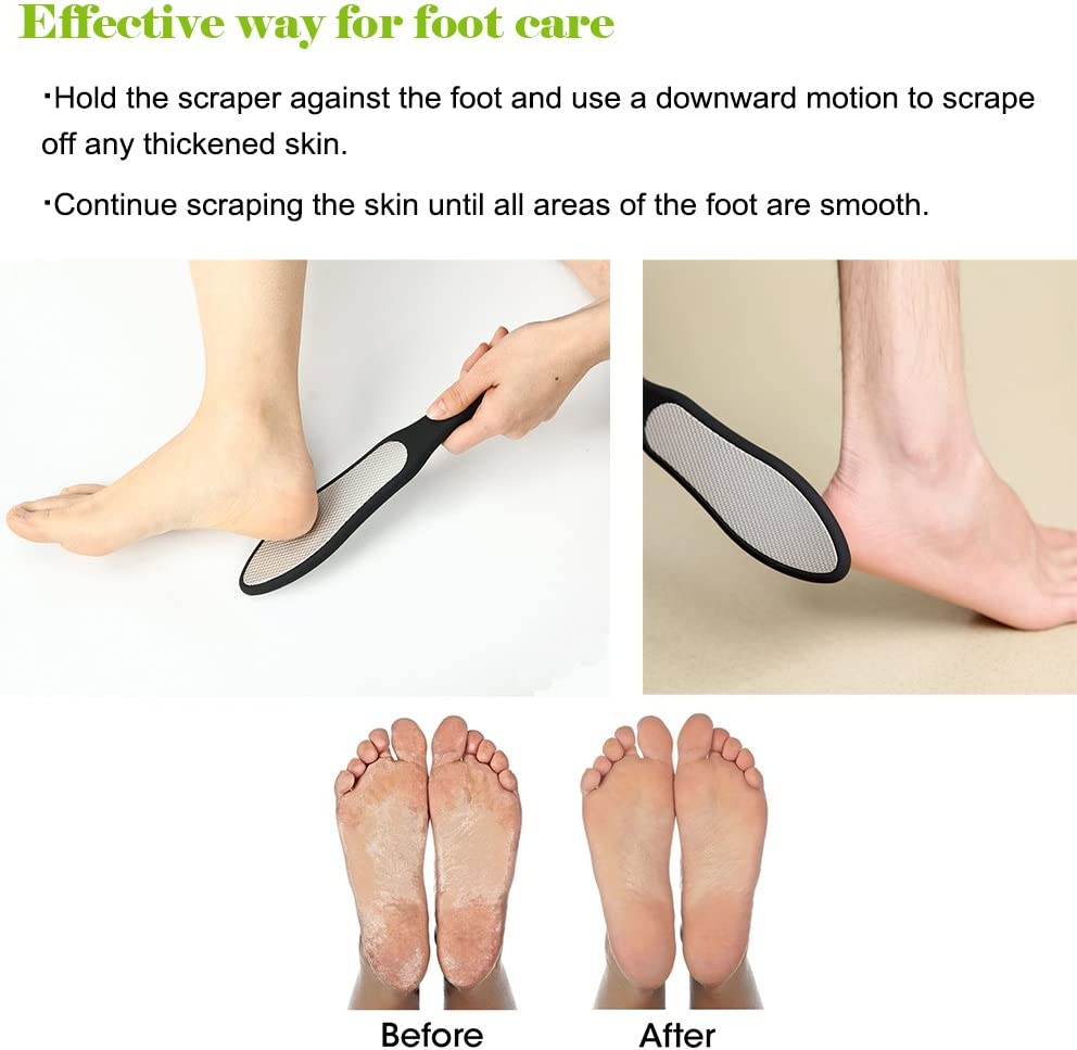 BEZOX Foot File Callus Remover Removes Dead and Shrinked Skin Callus Portable Foot Care Stainless Steel (Silicone Handle) image number 1