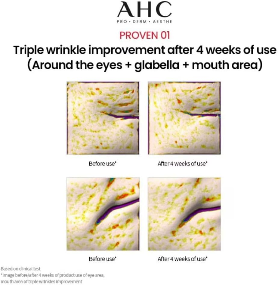 AHC PRO SHOT COLLA JUVENATION EYE CREAM for FACE 3 image number 4