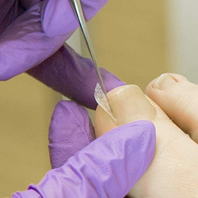 Kosmetex 2 X Tamponade for Nail Fold, 2 X Toe Bandages as Protection, Set 2 image number 4