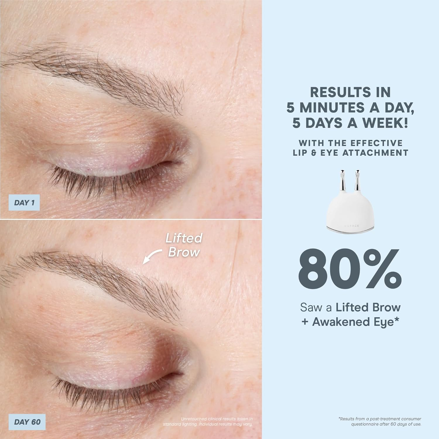 Nuface Advanced Facial Toning Kit, Trinity Facial Trainer Device + Hydrating Leave-On Gel Primer, Skin Care Device to Lift Contour Tone Skin + Reduce Look of Wrinkles, At-Home System image number 1