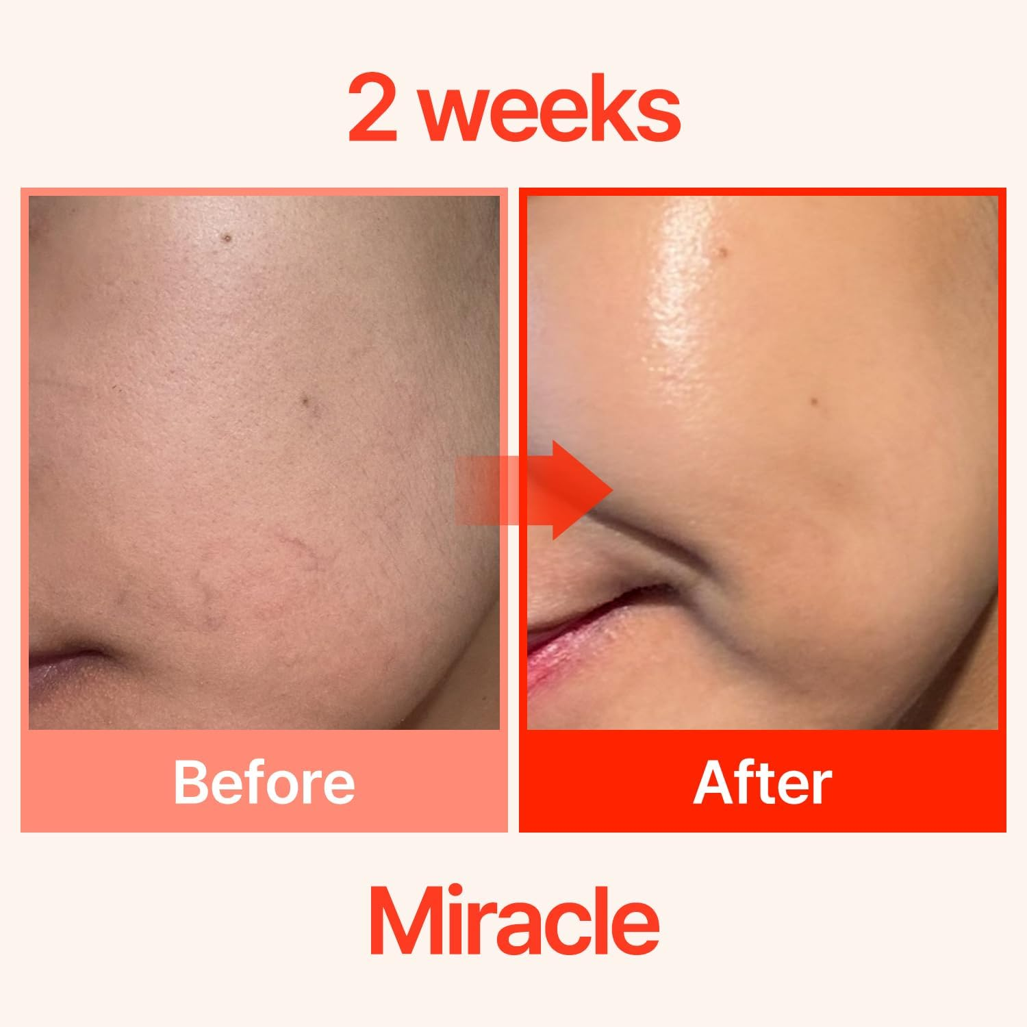 COSNORI Pdrn-Shot 675 - Korea Facial Serum with 675,000 High Purity Spicules - Turnover K-Beauty Face Serum with High Nutrition Salmon DNA PDRN - Intensive Facial First Essence (50Ml / 1.69 Fl. Oz.) image number 3