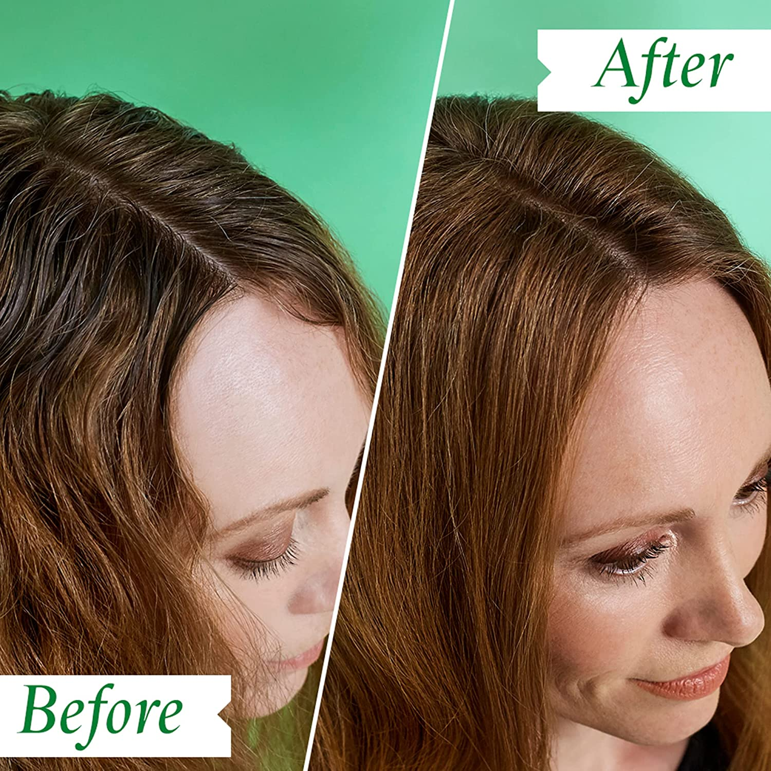 Philip Kingsley Flaky Itchy Scalp Shampoo, 1000 Ml image number 1