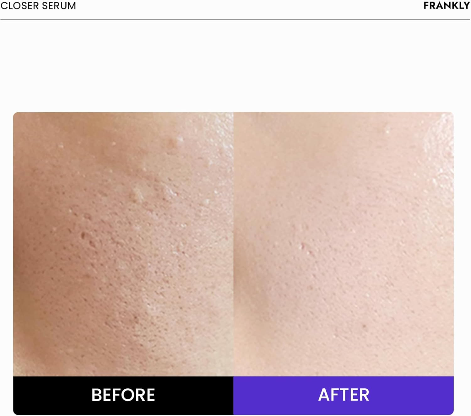 FRANKLY Closer Serum | Pore Minimizer Serum | 9 Peptides, Vegan Collagen, Adenosine, PHA | Korean Pore Minimizer for Glass Skin, Anti-Aging, Hydration, Elasticity | 1.01 Fl Oz image number 1