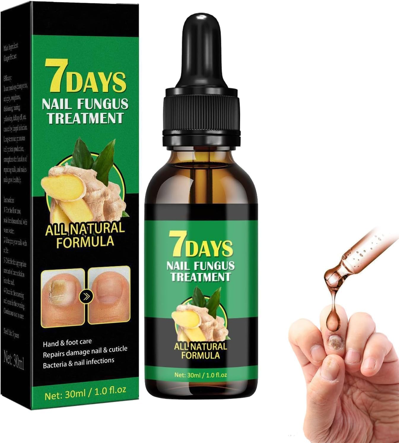 Ginger Nail Support Nail Care,Nail Strengthener for Damaged Nails,7 Days Nail Fungus Treatment,Toenail Cuticle Care Oil for Nails