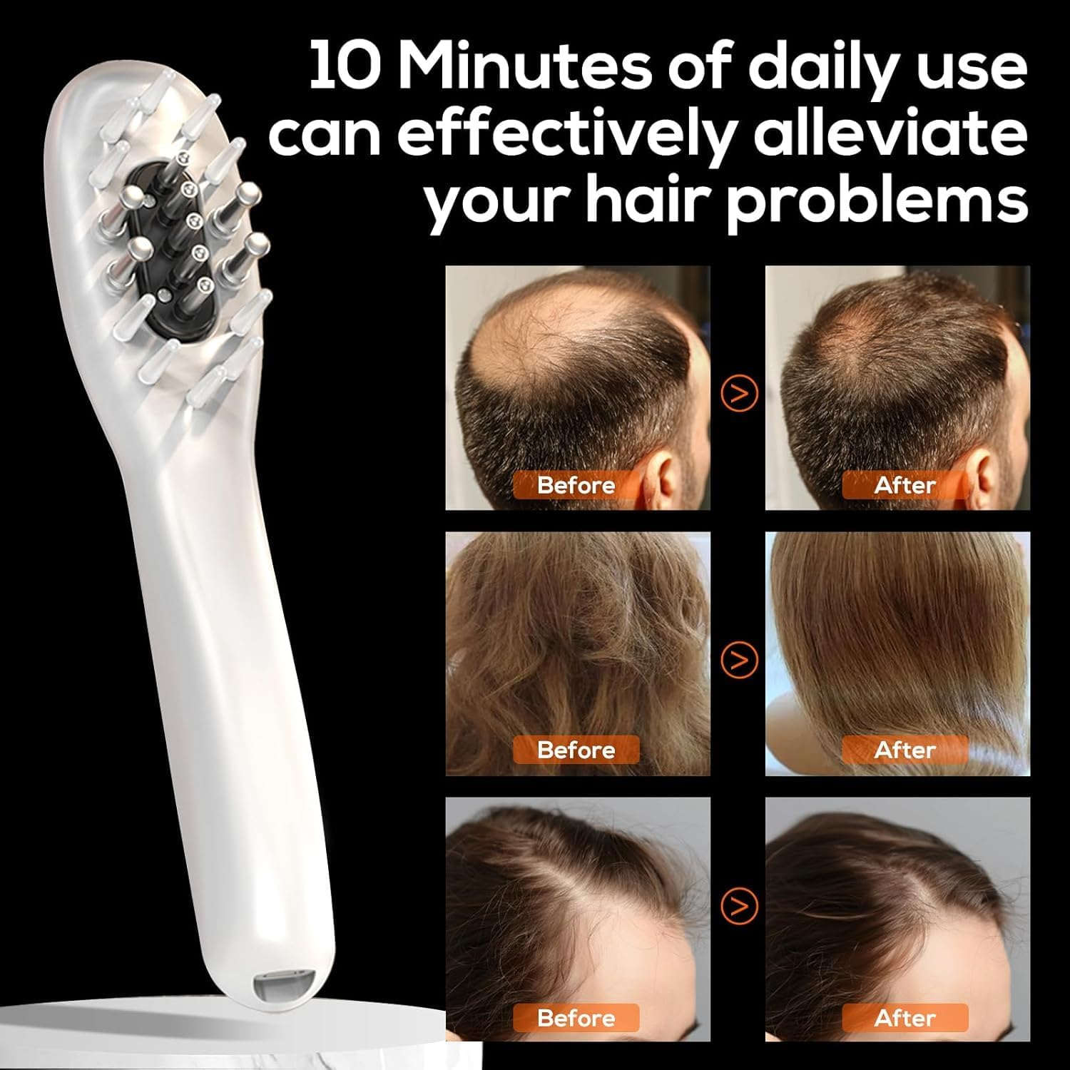 Havvo Laser Hair Growth Comb, Laser The- Rapy Comb, Electric Scalp Massager Hair Growth Device Comb Hair Loss Thinning Treatments for Men & Women Laser Comb for Hair Growth Red Light Comb image number 6