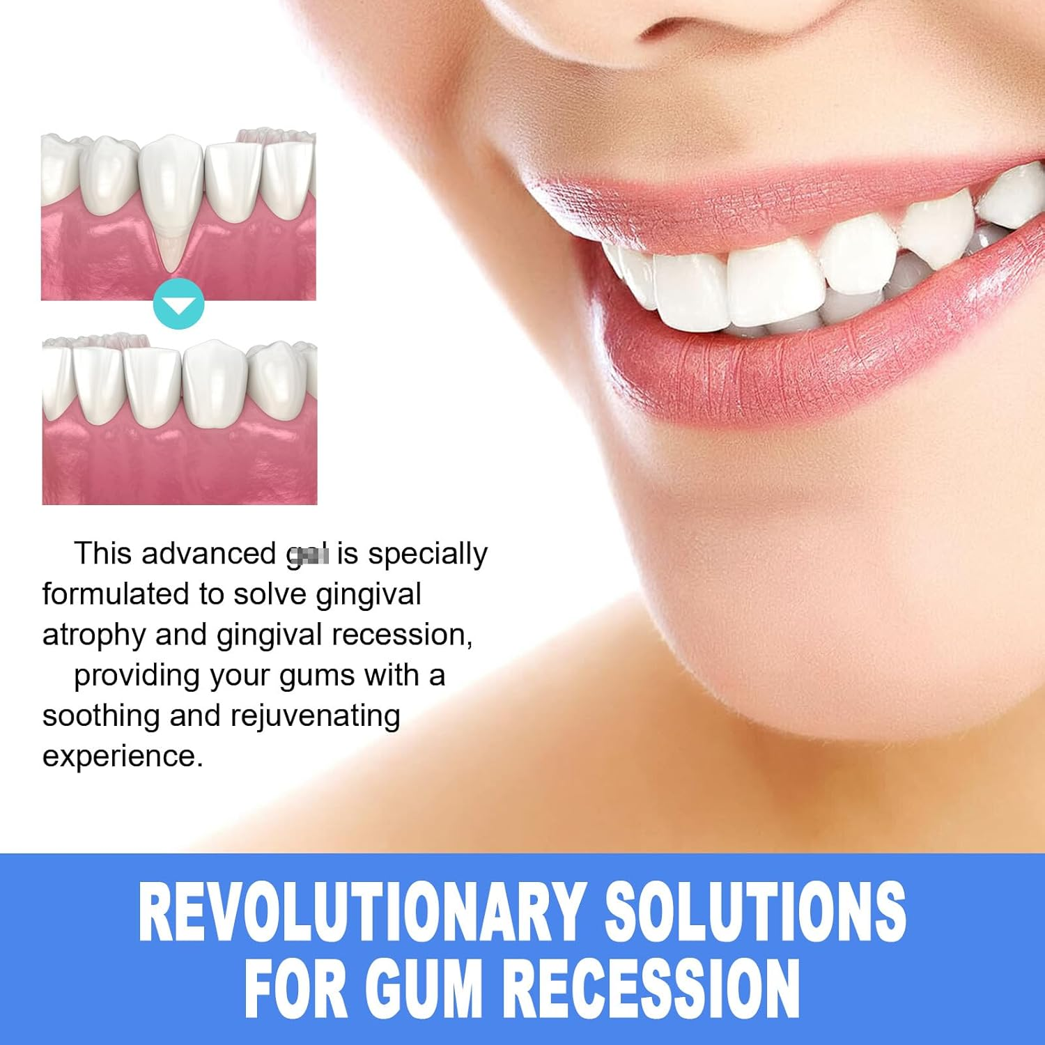 Gum Support Gel for Receding Gums - Protection & Care Formulation Shields Gums, Freshens Breath (4Pcs) image number 2