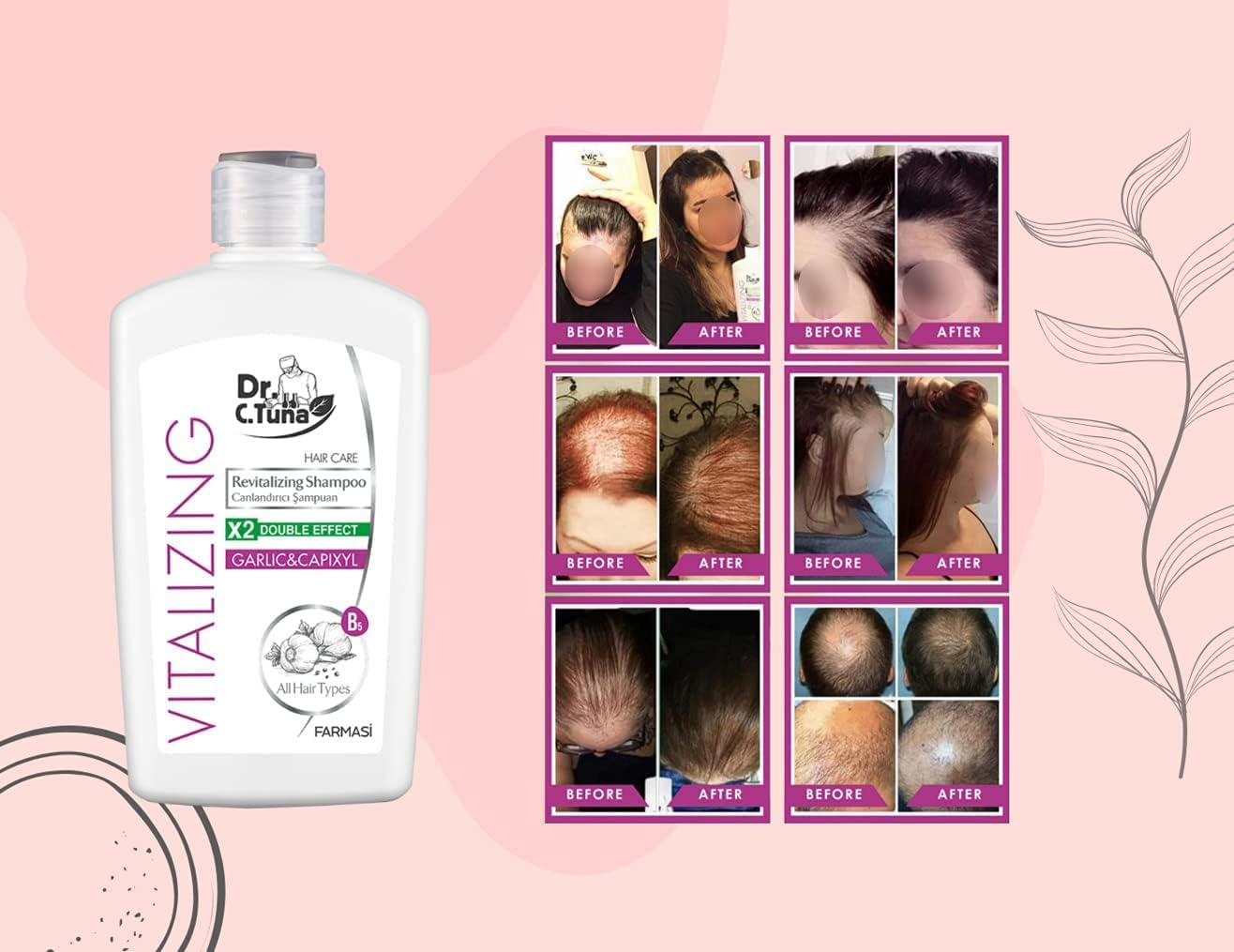 Kenparazzi Vitalising Garlic Shampoo 500 Ml - Protects against Breakage and Spills. Formula Developed and Enriched with Garlic and Capixy, 1108062 image number 4