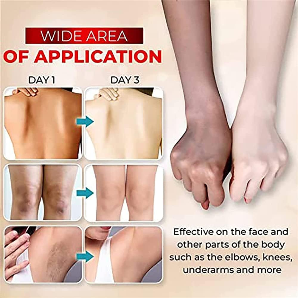 2Pcs 3 Days Kojic Acid Whitening Moisturizing Cream, Skin Lightening Cream for Dark Skin, Kojic Acid Cream for Dark Spots,Brightens Skin Hydrating Nourishing Skin Bleaching Cream（50G） image number 1