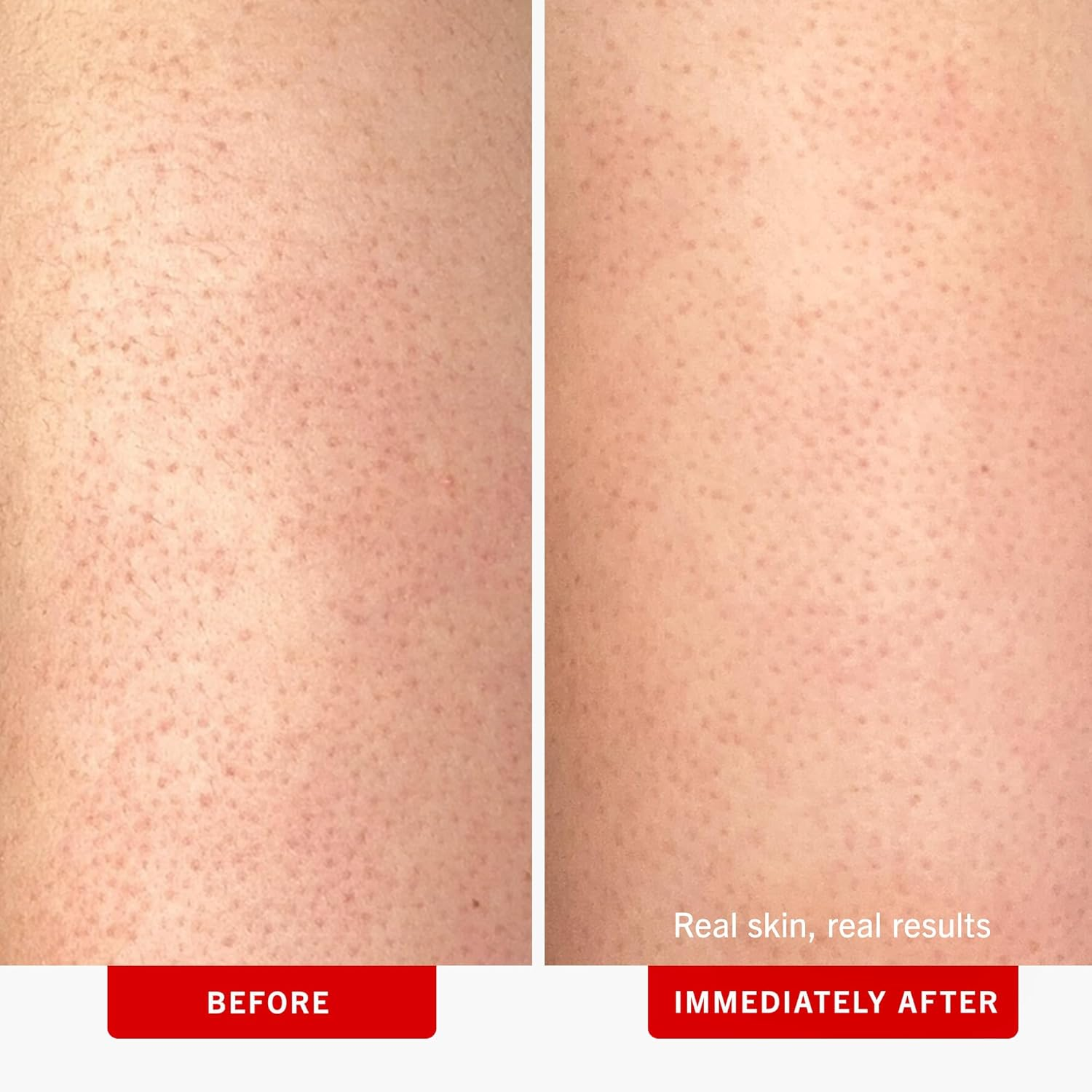 First Aid Beauty - KP Bump Eraser Body Scrub with 10% AHA, Keratosis Pilaris Skin Exfoliater with Glycolic and Lactic Acids, Helps Reduce Chicken Skin Bumps, Safe for Sensitive Skin, 4 Oz image number 2