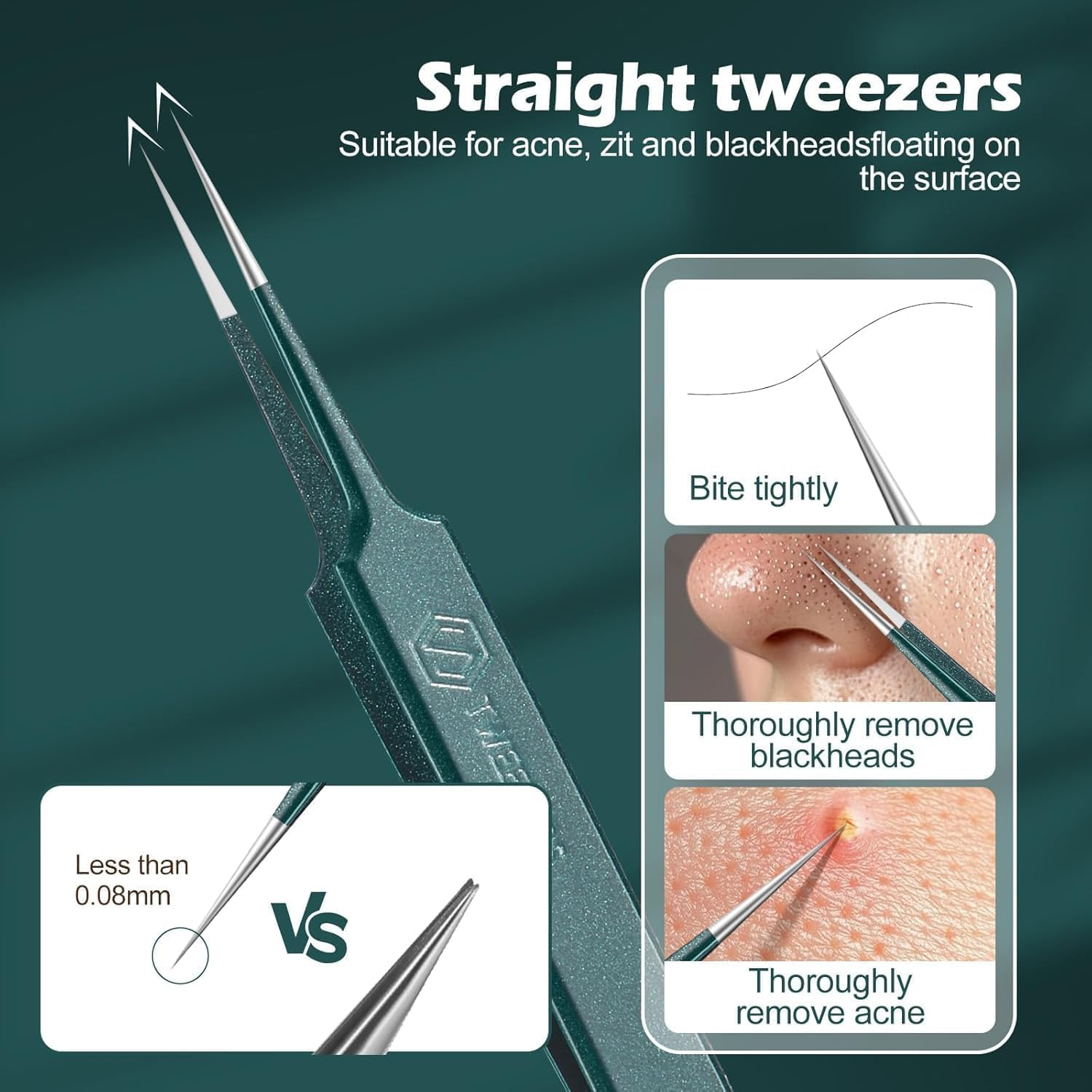 Upgrade Facial Blackhead Remover Tweezers, Ingrown Hair Tweezers,Extractor Acne Removal, Pimple Popper Tool Suit with Box (Green, 3Pieces/1Set) image number 1