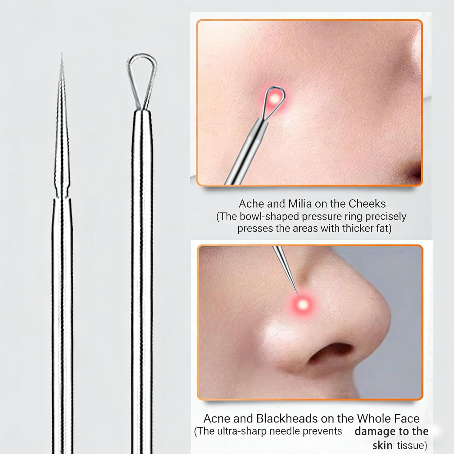 Yxvyxymyxxg Titanium Lancet Needle Pimple Popper Tool Professional Comedone and Blackhead Remover for Facial Milia Whitehead Extractor Skin Care Kit 2 Pieces with Storage Box image number 2