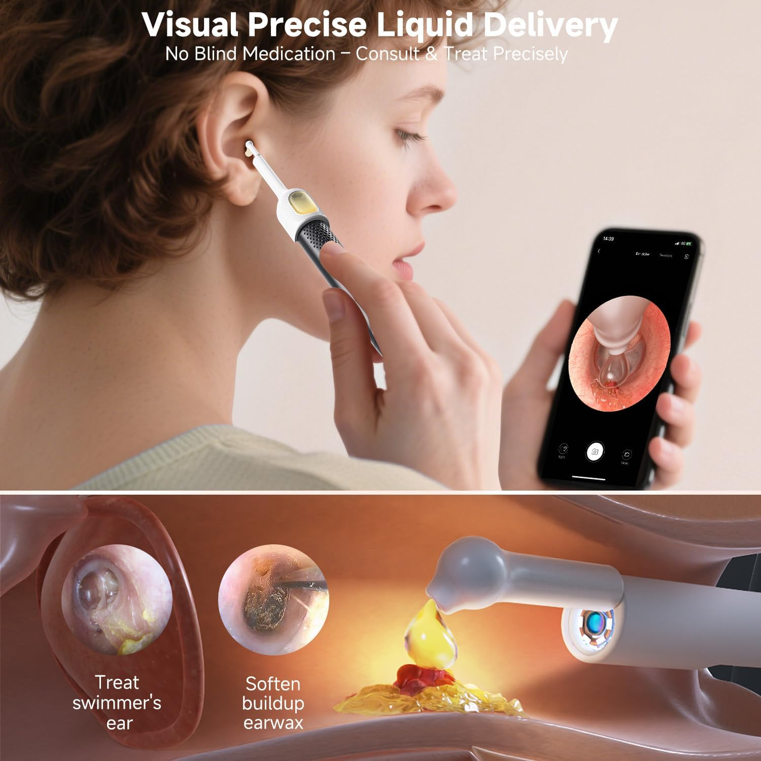 BEBIRD R1 Max Ear Wax Removal, Ear Cleaner with Camera and Light, Ear Scope Otoscope Ear Pick Tweezers with Cam, Visual Dropper Ear Care Cleaning Kit, Ear/Nose/Throat Examination Tool for Family image number 5