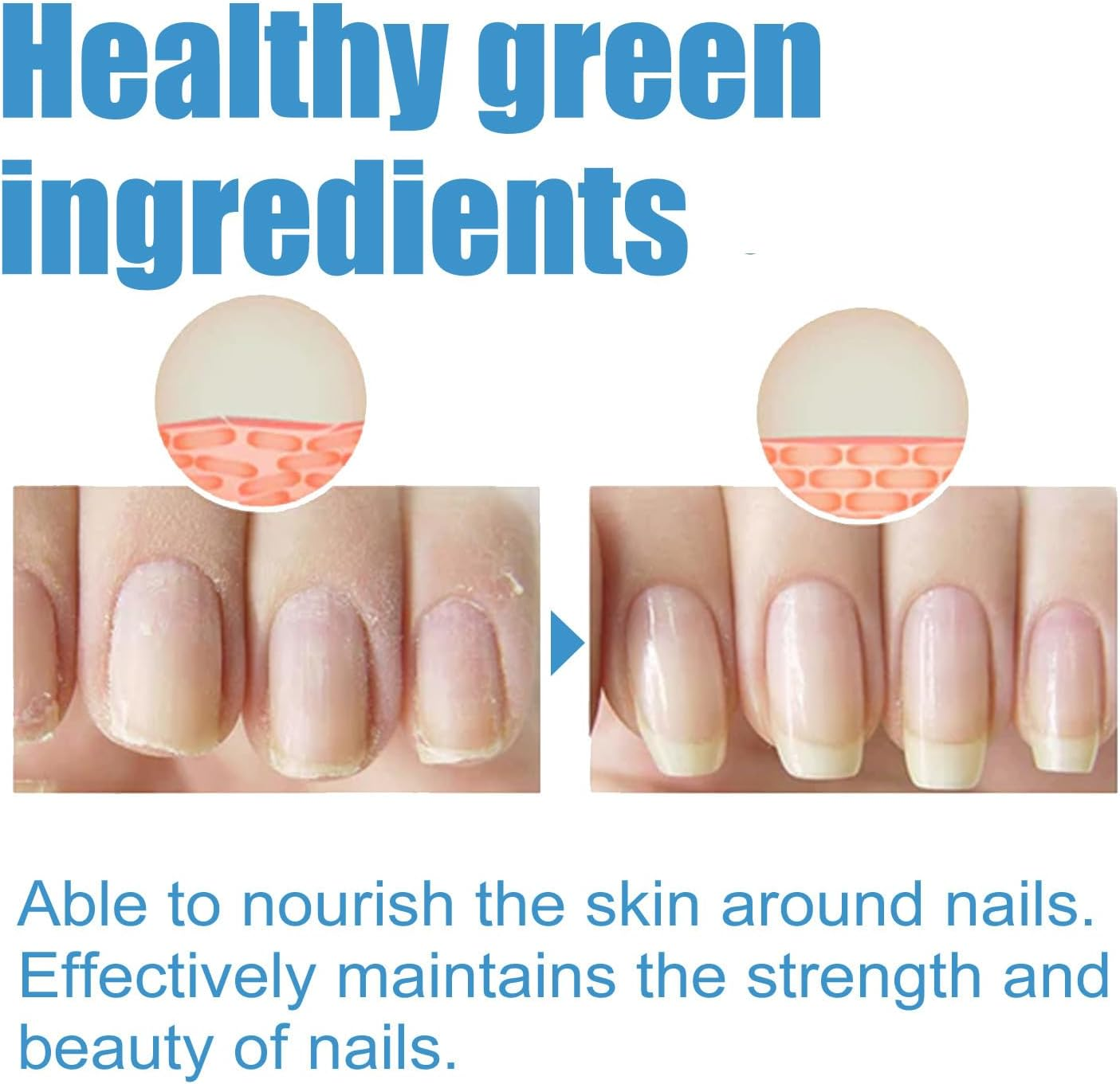 30ML Fungal Nail Treatment for Toenails & Fingernails to Improves Brittleness & Discoloration, Nail Tending for Stronger, Healthier-Looking Nails image number 6