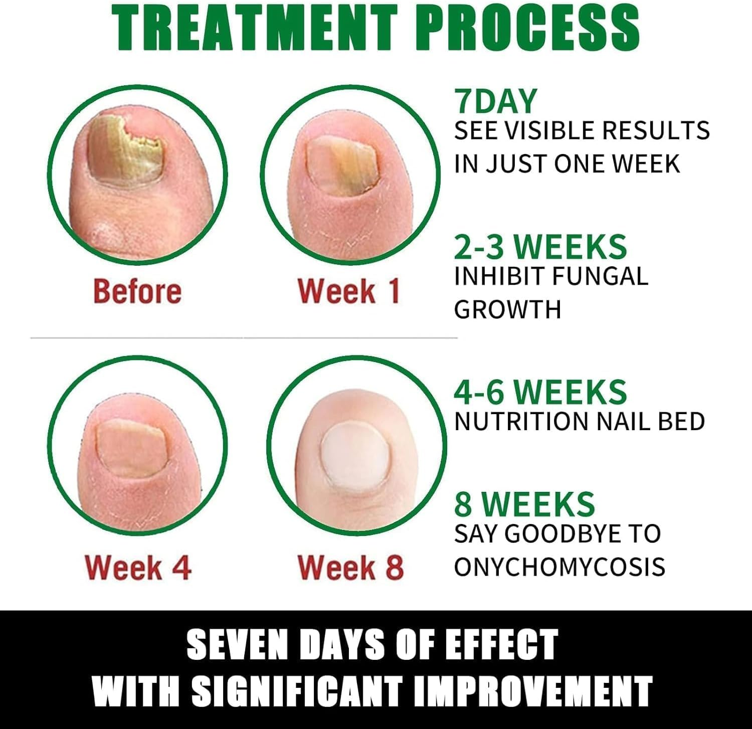 Ginger Nail Support Nail Care,Nail Strengthener for Damaged Nails,7 Days Nail Fungus Treatment,Toenail Cuticle Care Oil for Nails