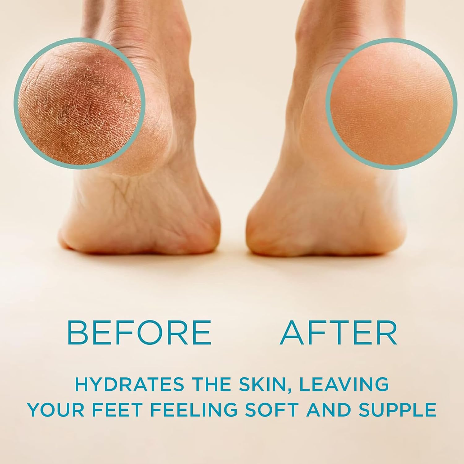 Lee Beauty Professional Callus Remover for Feet - Extra Strength Gel & Rasp Foot File Kit - Original Formula for Dead Skin Remover for Cracked Heels & Dry Skin-Pedicure Supplies for Smooth Foot - 8 Oz image number 1