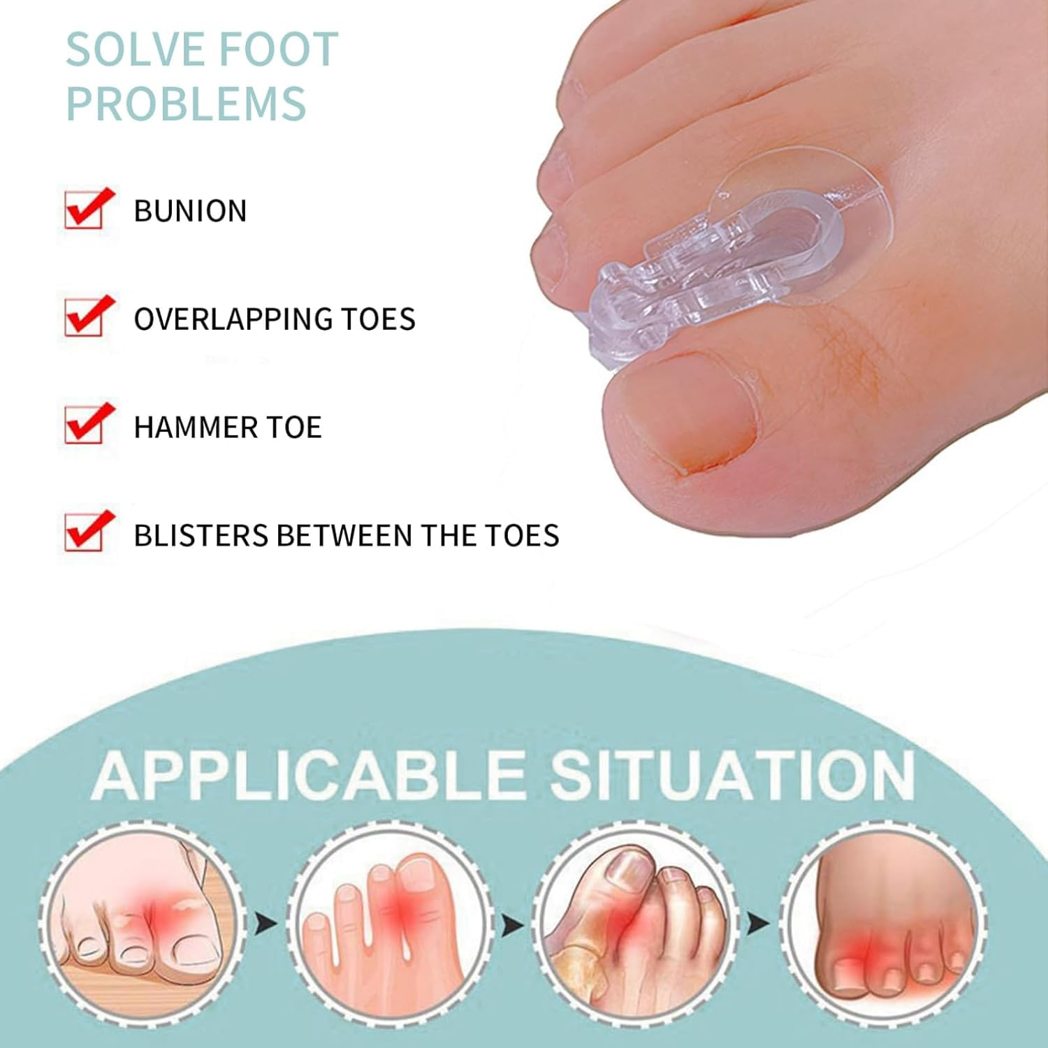 Memnun'S Soft and Highly Elastic SEBS Toe Separators, Hallux Valgus, Bunion,Hammer Toe, Overlapped Toe Corrector, Yoga Toe Separator, 10 Pieces image number 1