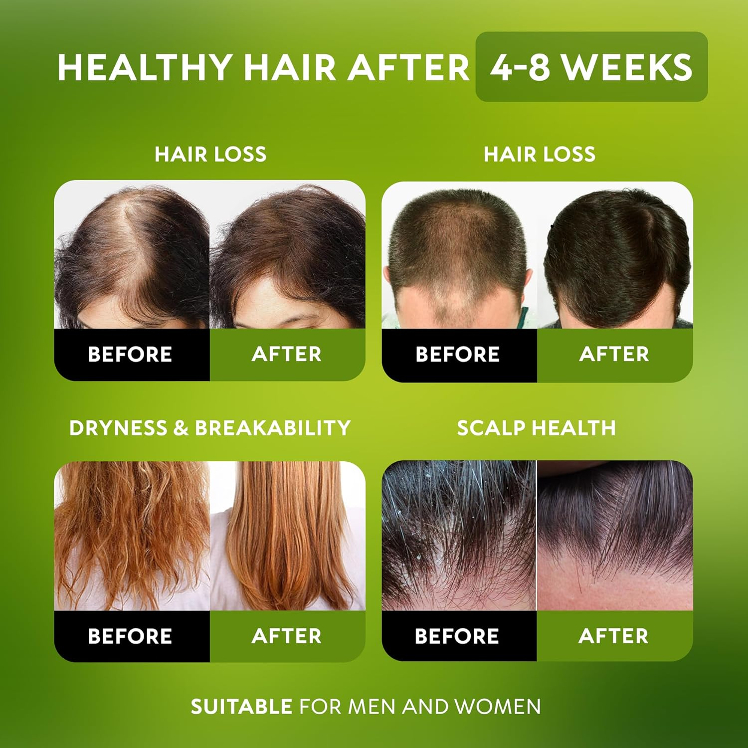 Batana Oil - 100% Raw & Organic Dr Sebi Batana Oil - Cold-Pressed & Pure Unrefined Batana Hair Mask for Women & Men