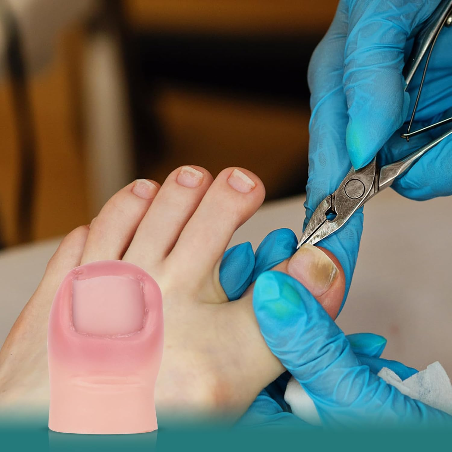 Mededuquest Ingrown Toenail Trainer, Ingrown Toenail Model, Wound Care Training Model for Medical Education