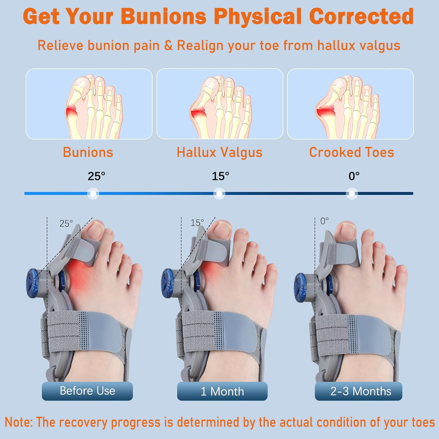 Bunion Correctors for Men and Women, Adjustable Knob Toe Straightener, for Bunion and Big Toe Pain Relief, Adjustable Bunion Splints (Gray) image number 6