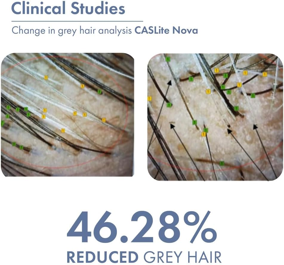 Thriveco Anti-Grey Hair Prime Serum | Reverses & Limits Hair Greying | Arcolys + Biotin + Black Tea Extract | Light-Weight, Non-Sticky & Odourless | for Men and Women | 30 Ml image number 3