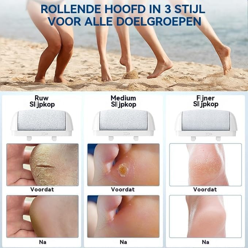 AOMEES Improved Electric Callus Remover, Rechargeable Electric Callus Remover with 3 Speeds, 3 Changing Rollers, IPX7 Waterproof, Foot Care Set for Callus Removal