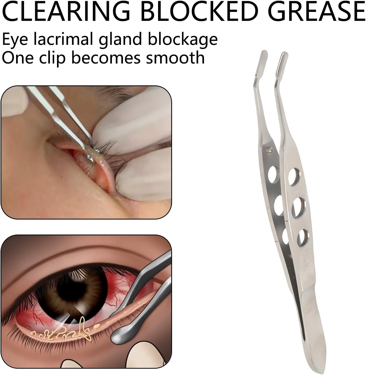 Luzcauwy Eyelid Massage Tool - Professional Stainless Steel Eye Beauty Tweezers for Relaxation - Smooth Square Head Eye Spa Accessory for Daily Care (10Cm) image number 4