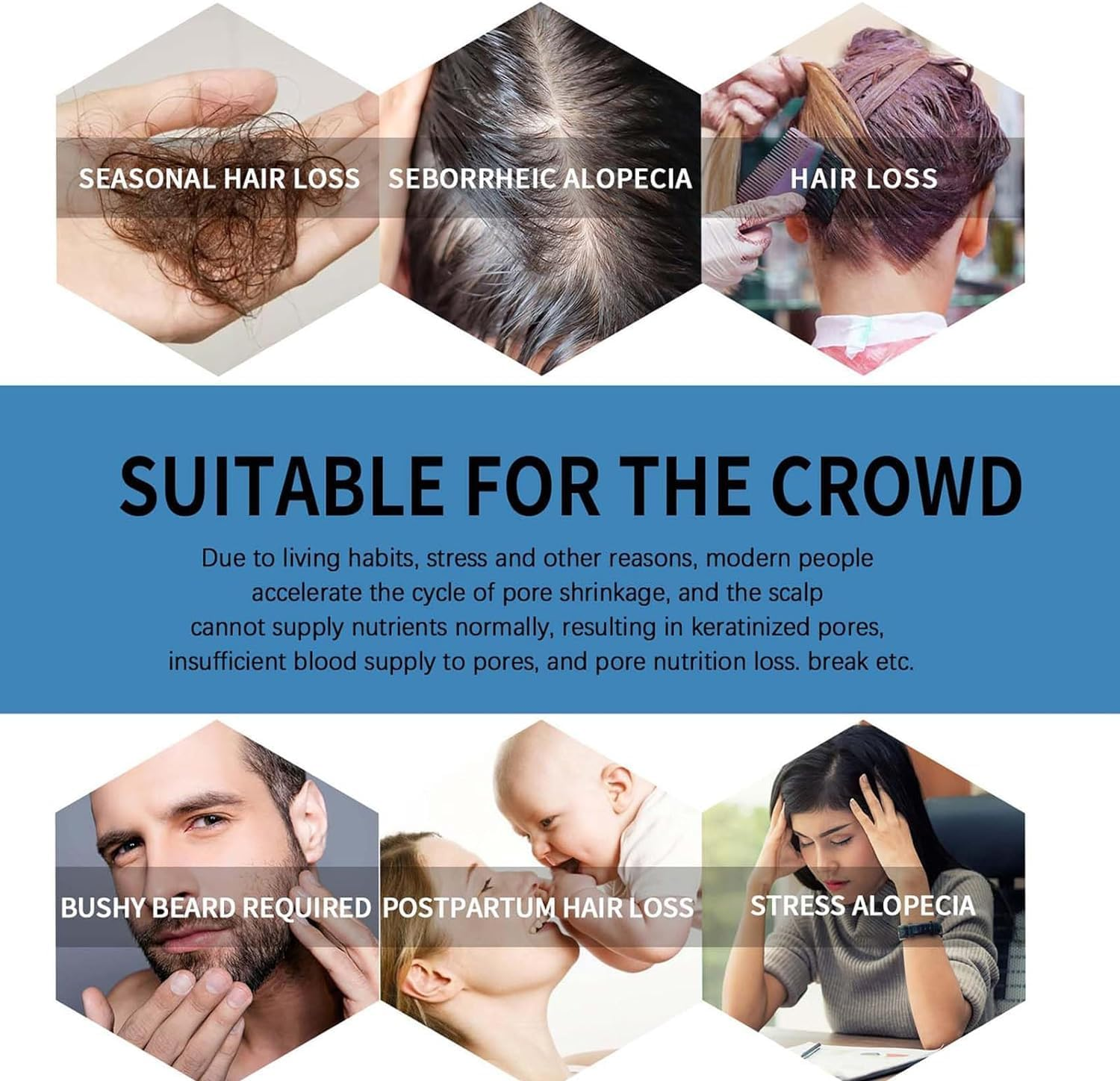 3 Pcs Renew Hair X Roll-On Hair Treatment,Renewhairx Hair and Beard Regrowth Roll on Serum,Beard Hair Regrowth Treatment Works on All Hair image number 3